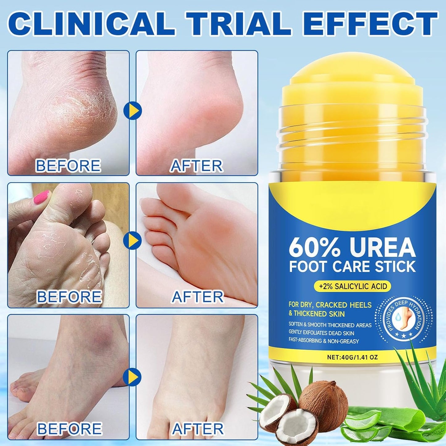 Urea Cream Foot Care Stick - 60% Urea & 2% Salicylic Acid for Dry, Cracked Skin | 1.4oz (2pcs)
