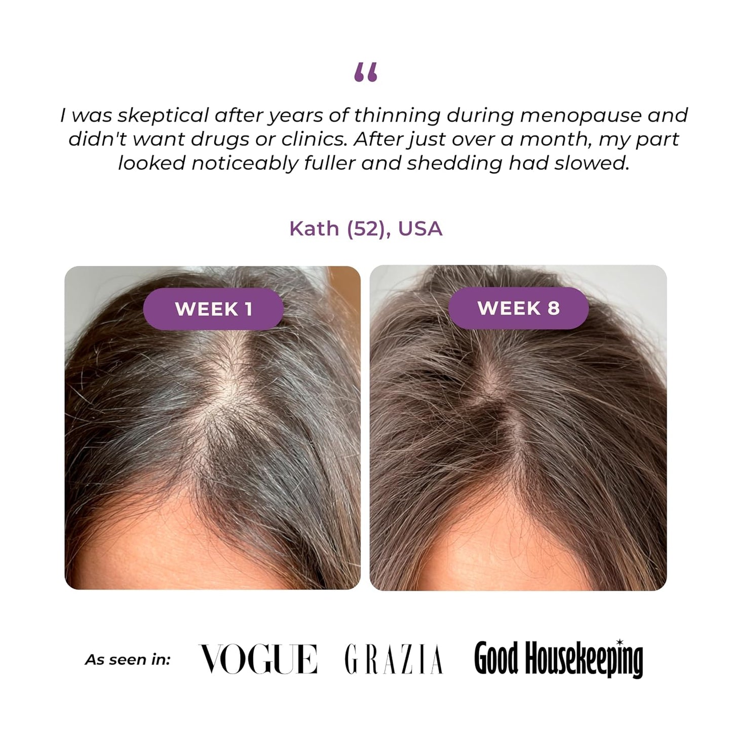 Hair Growth Serum for Mature Women | Peptide & Caffeine Formula for Thicker, Fuller Hair - Reduces Shedding - Menopause Safe