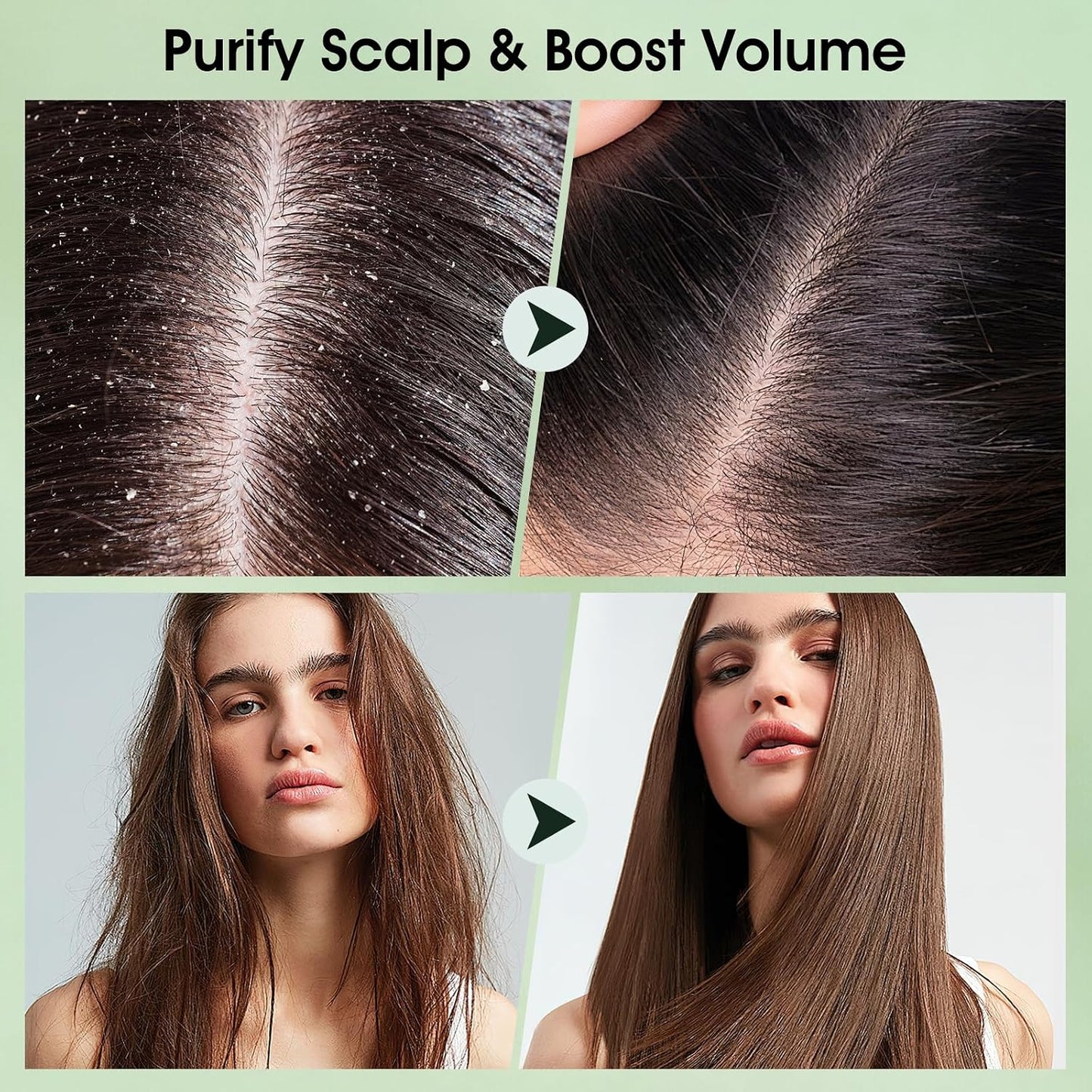 Tea Tree Scalp Scrub - Exfoliating Shampoo with Mint Oil & Silicone Massager | 10.6oz/300g