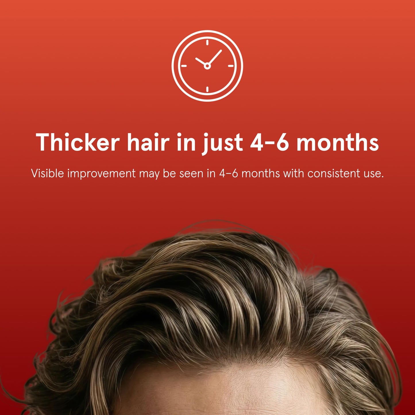 Keeps Minoxidil Solution 5% for Men - Extra Strength Topical Hair Regrowth Treatment - Non-Greasy Scalp Solution - Clinically Proven to Increase Hair Growth - 3 Month Supply (3 x 2 fl oz Bottles)