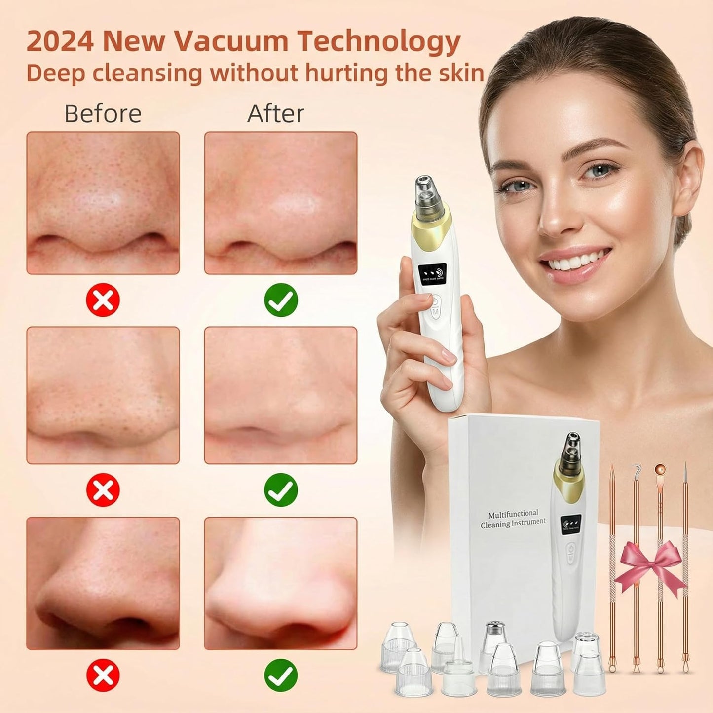 Pore Vacuum Blackhead Remover - USB Rechargeable, 3 Adjustable Levels, 5 Suction Powers, 6 Probes | Face Cleanser for Women & Men - Gold