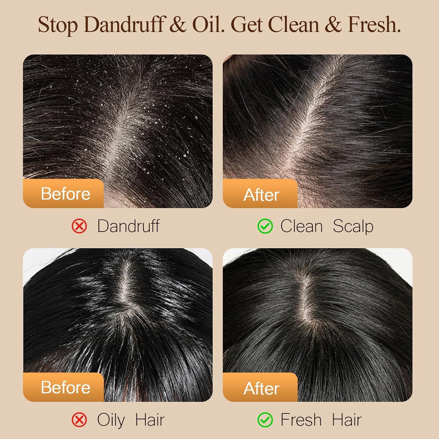Sulfate-Free Anti-Dandruff Shampoo & Conditioner Set - Argan Oil Treatment for Oily, Dry, Damaged & Curly Hair | 27 Oz