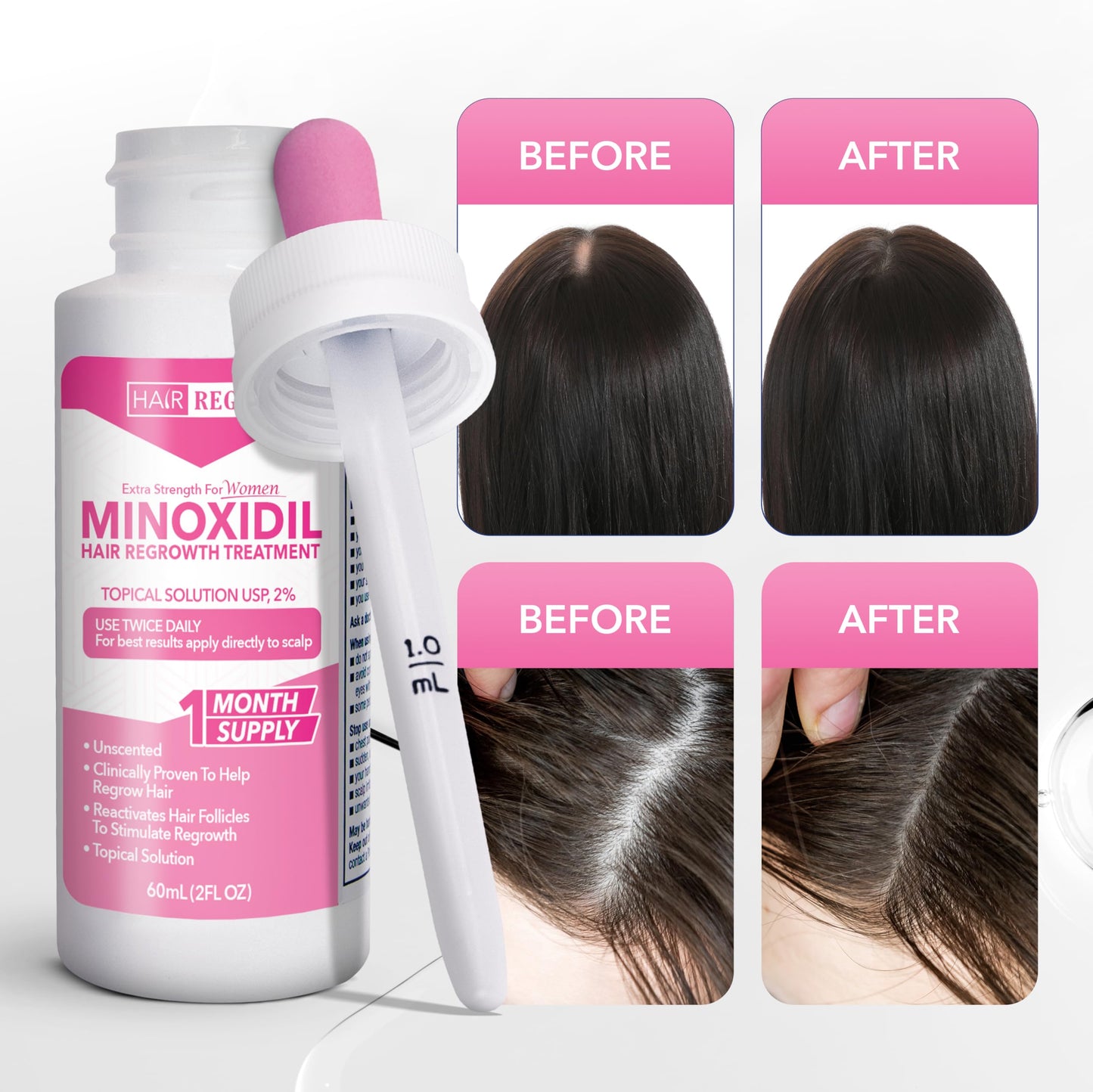 Hair Regen Liquid Minoxidil Women 2% Percent - Extra Strength Advanced Topical Solution for Regrowth Serum Drops - Clinically Proven Growth Treatment for Hers Hair Loss 6 Pack as 6 Months Supply Kit