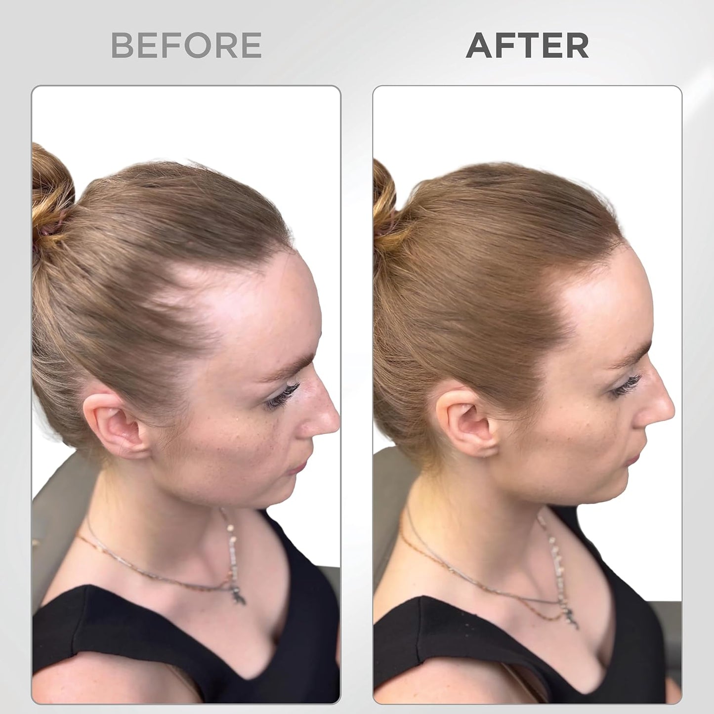 Root Touch Up Set - Water & Sweat Resistant Hair Loss Concealer for Thinning Hair | Auburn Hairline Powder & Brush