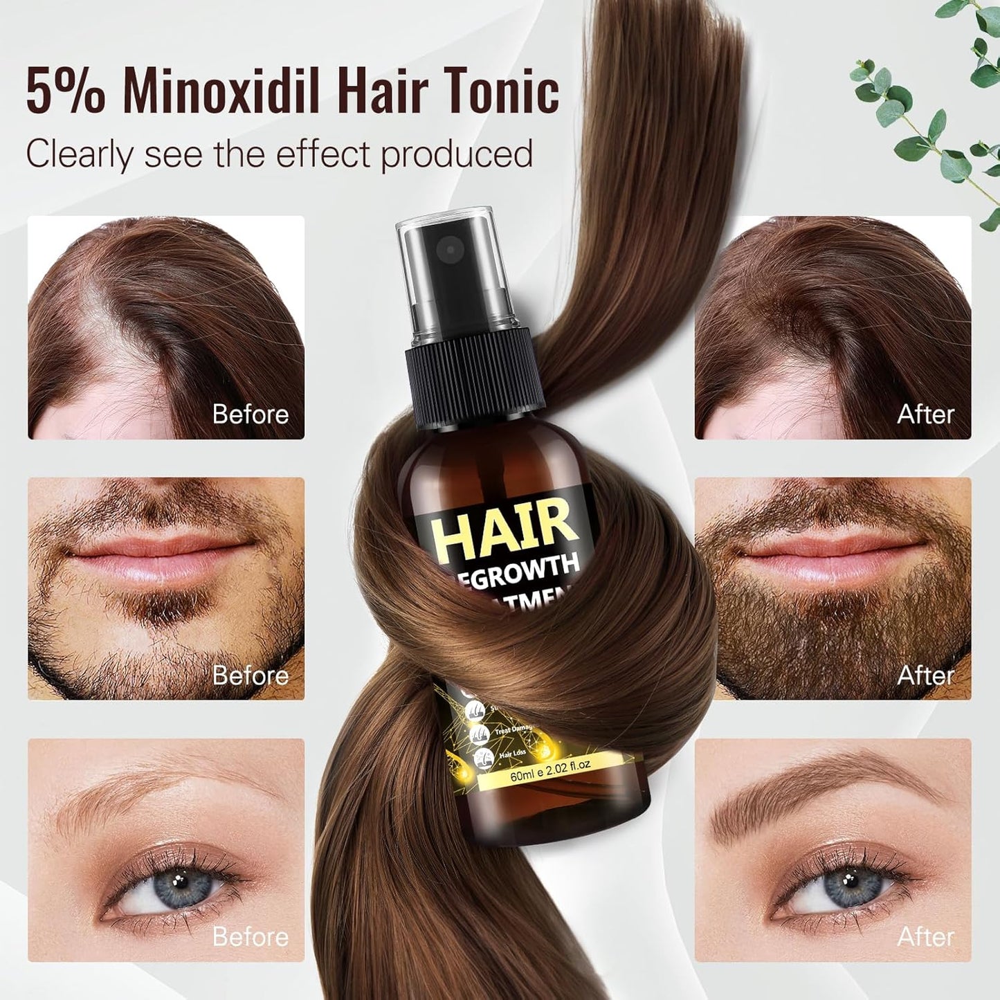 Minoxidil Hair Regrowth Spray - 5% Topical Solution for Thinning Hair & Beard Care | Unisex Formula