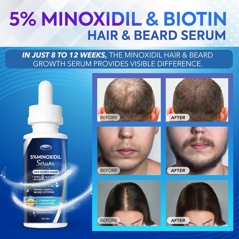 Minoxidil Hair Growth Serum - Extra Strength Beard Regrowth Treatment with Biotin | 60ml, 4 Bottles for Thicker Hair