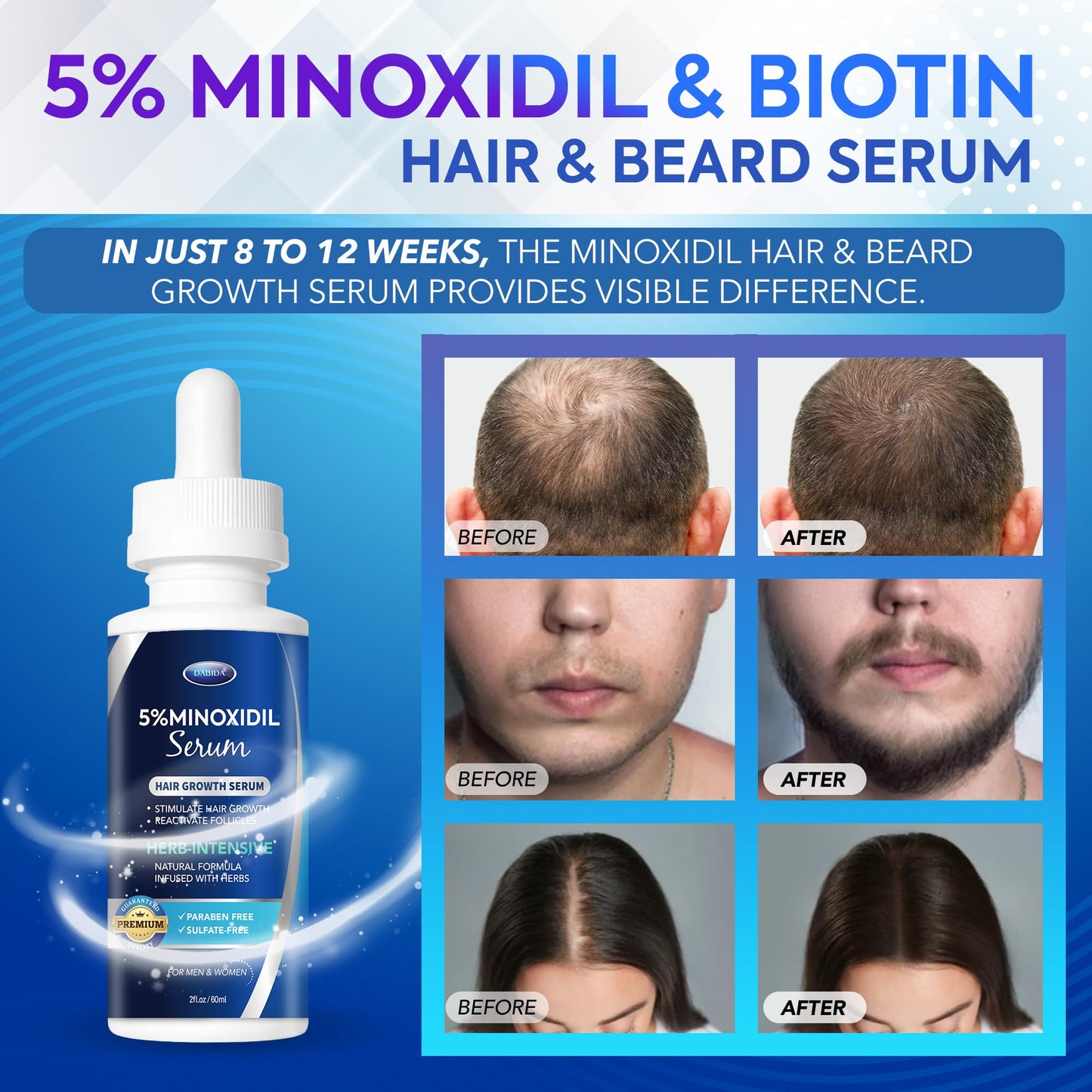 5% Minoxidil Hair Growth for Men and Women: Extra Strength Minoxidil and Biotin Beard Regrowth Serum for Thinning Hair Loss to Grow Thicker Fuller Hair 60ml 4 Bottles