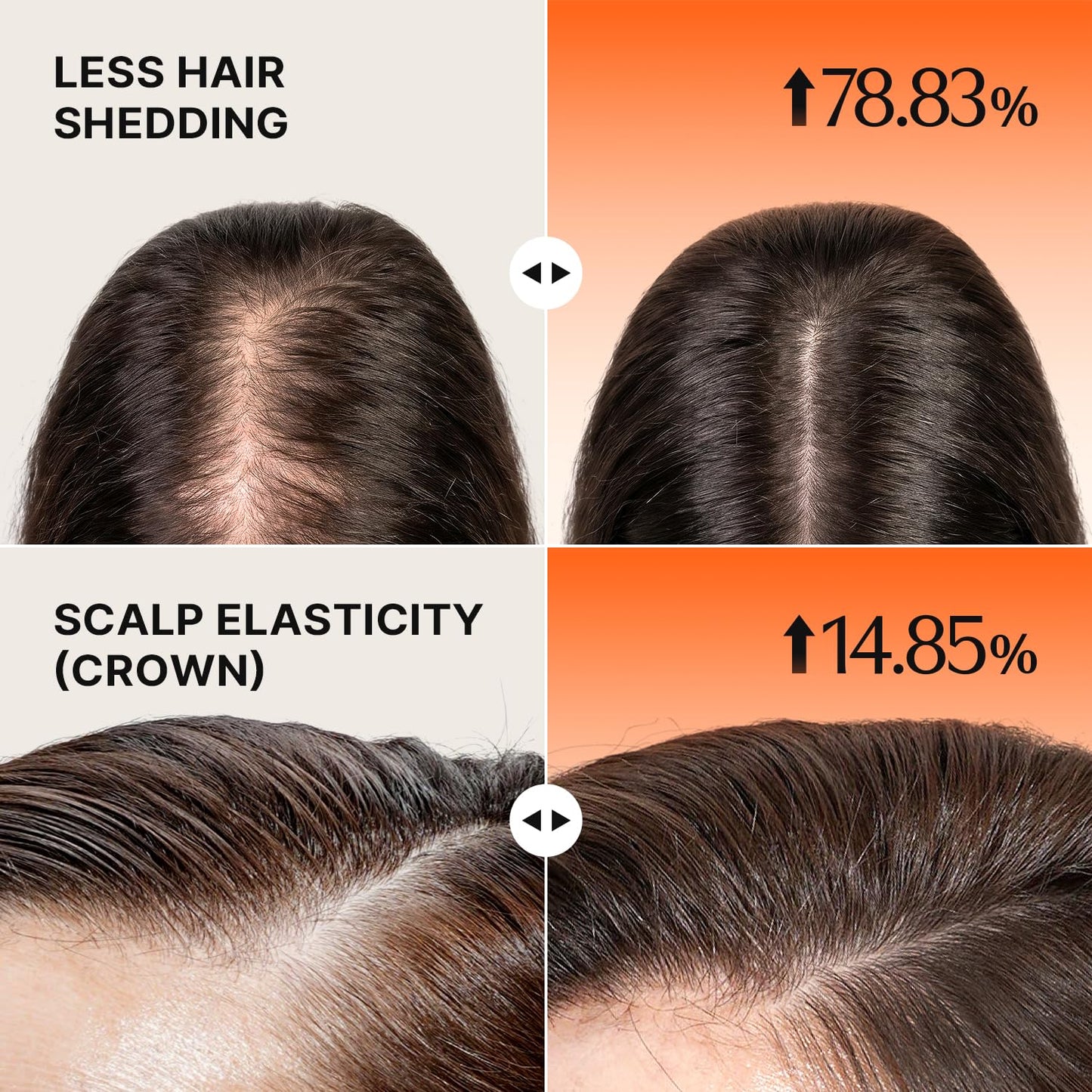 Lilyeve GROWTURN Hair Growth Set - Intensive Scalp Treatment with Spicule 0.33oz & Hair Ampoule 3.38oz