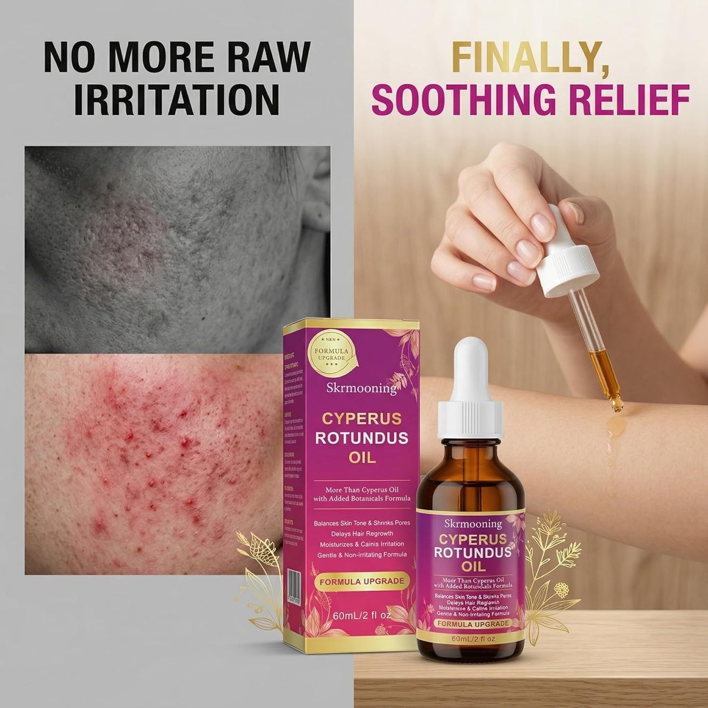 Cyperus Rotundus Oil - Natural Hair Removal Oil with Aloe Vera & Jojoba | 2PCS for All Skin Types