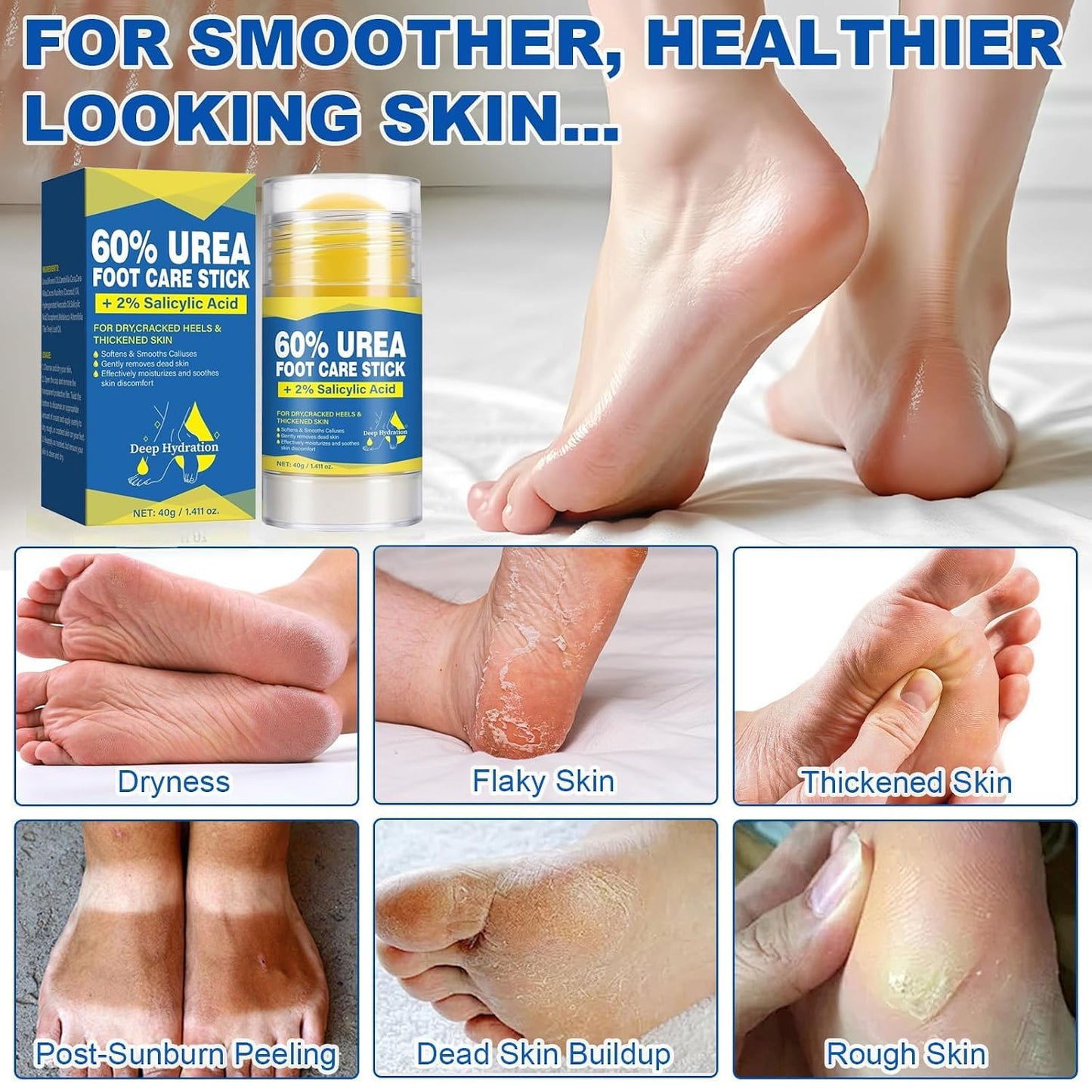 Urea Foot Cream Stick - 60% Urea & 2% Salicylic Acid for Dry, Cracked Feet | Fast-Absorbing Moisturizer, 1.41 oz