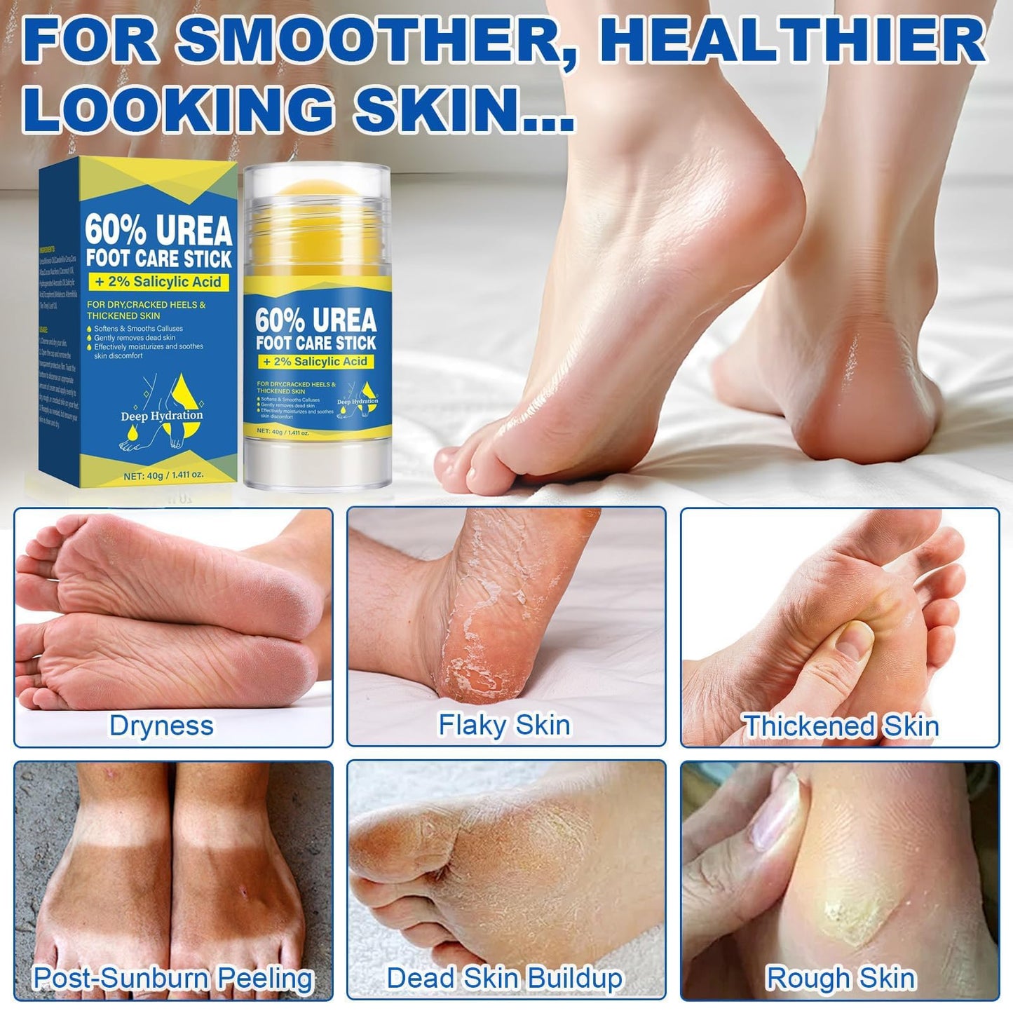 QVCQ 60% Urea Foot Cream Stick with 2% Salicylic Acid, Intensive Heel Balm for Dry Cracked Feet, Rough and Thick Skin, Fast-Absorbing Foot Repair Moisturizer for Heels, Elbows and Knees, 1.41 Oz