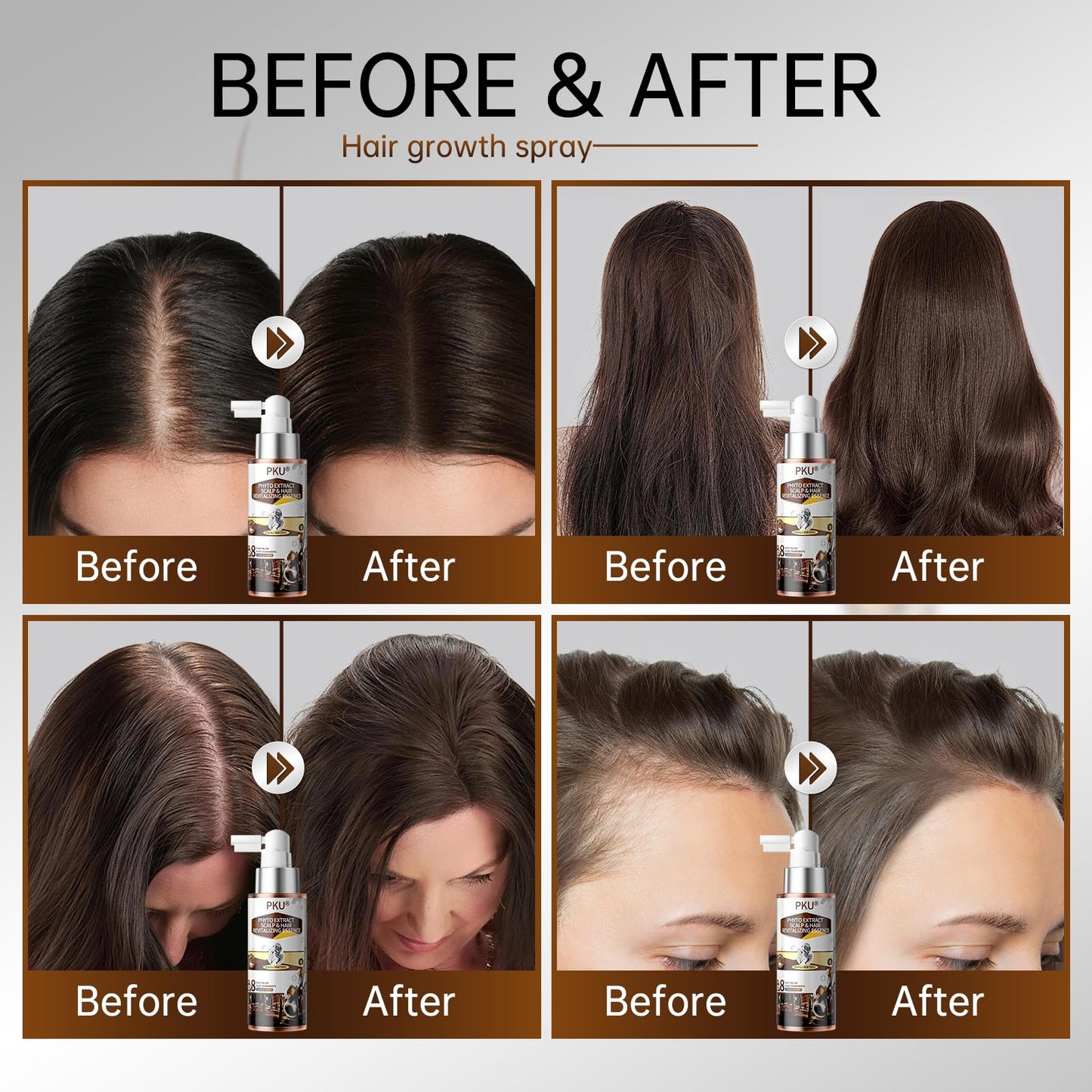 PKU Hair Growth Spray - Biotin & Rosemary Oil Hair Serum - Nourishing Scalp Care for Thinning Hair - Plant Based with Ginseng & Arborvitae for Thicker Shinier Hair - Men and Women, 60ml