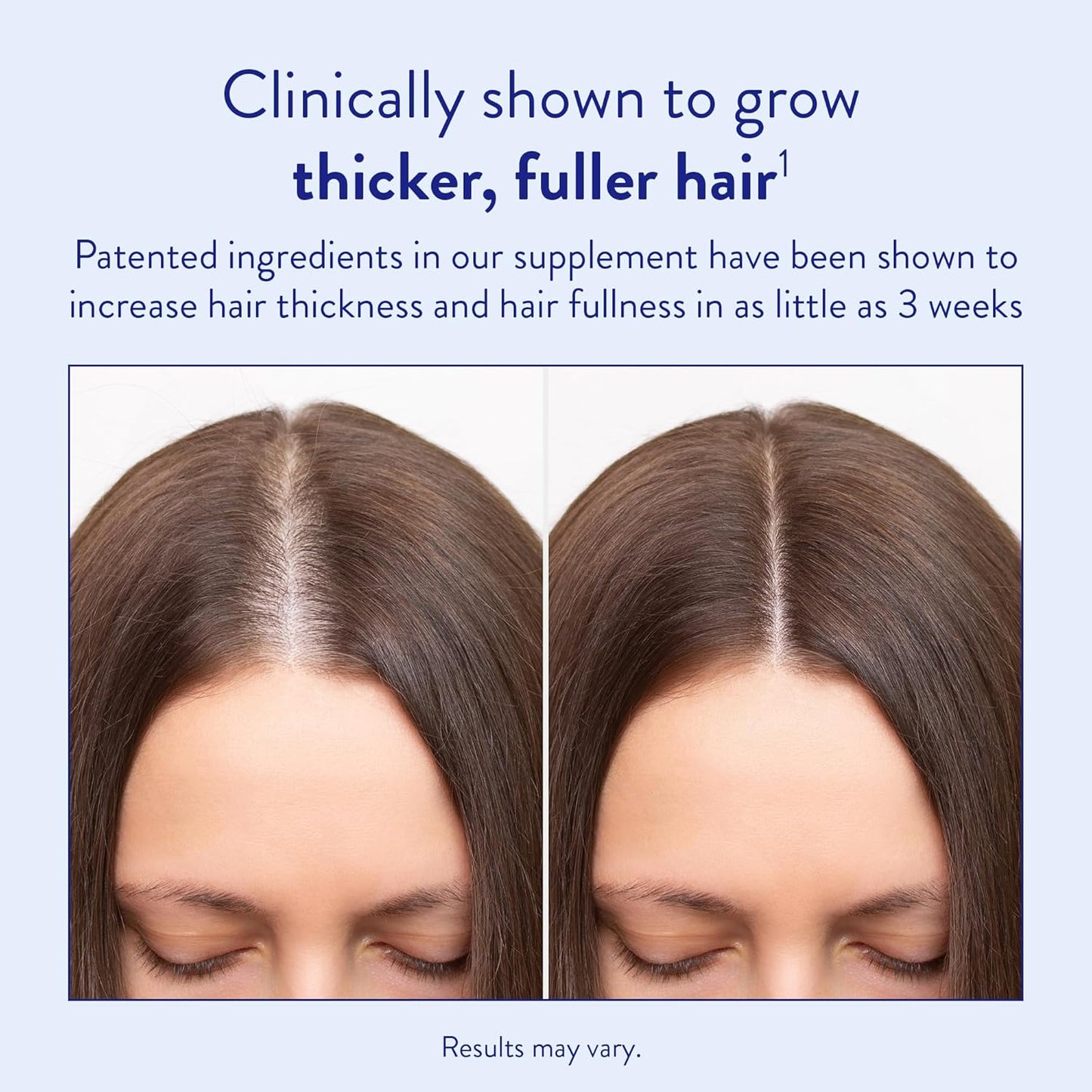 Hair Growth Supplement - Clinically Tested Biotin Formula for Thicker, Fuller Hair | Vegetarian, Gluten-Free, 30-Day Supply
