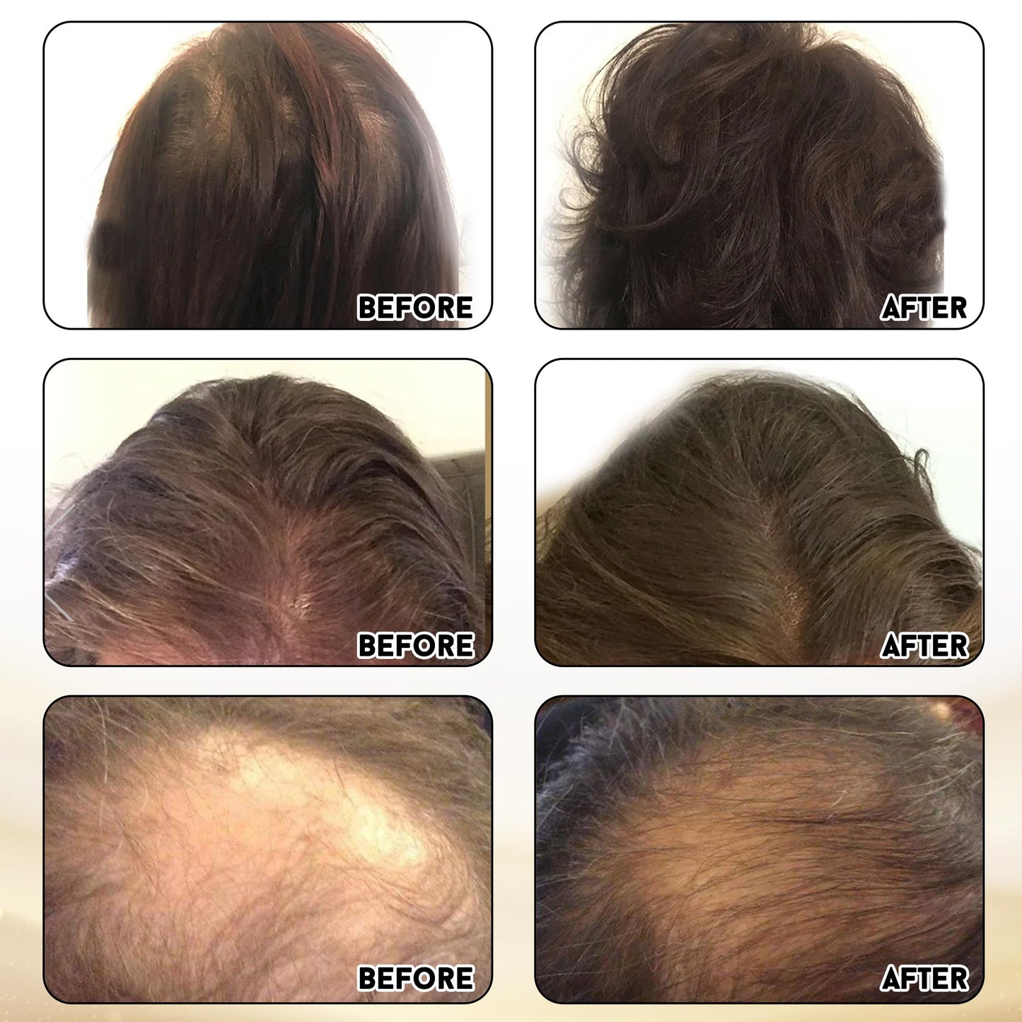 Joyce Giraud Ultimate Hair Strength Supplements 30-Day Supply, Scientifically Formulated to Reduce Hair Loss, 60 Capsules