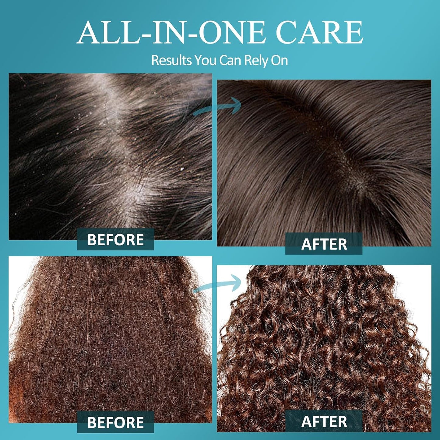 Biotin Scalp Scrub - 2-in-1 Exfoliator & Detox Shampoo with 3% Salicylic Acid | Tea Tree Oil for Dandruff & Itchy Scalp