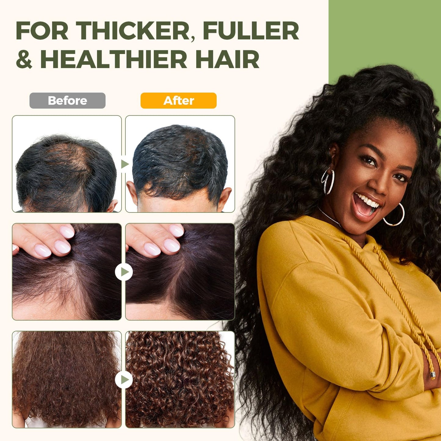 Mixgee Batana Oil Balm for Hair Growth & Thickness, Natural Formula With Batana & Rosemary Oil & Biotin, Promotes Scalp Health for Thicker, Fuller Hair(4.23 OZ)