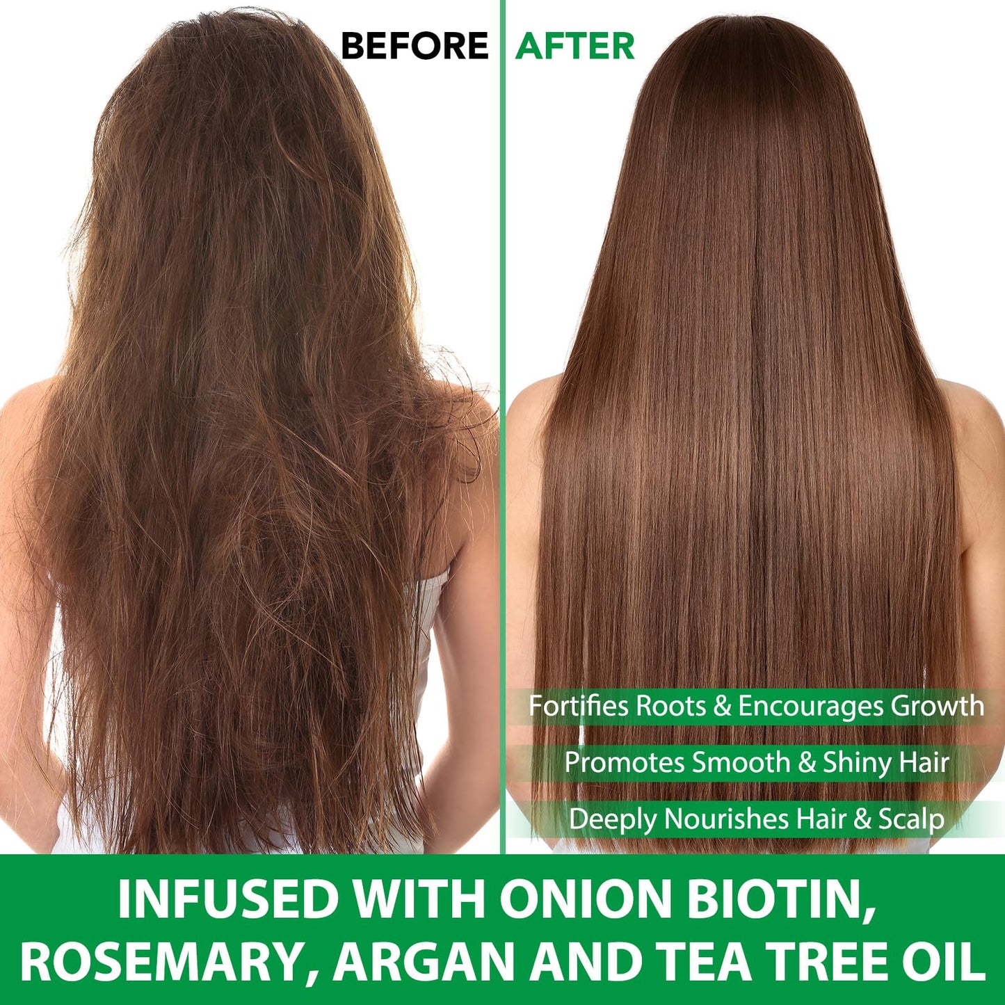 Batana Oil Hair Growth Shampoo and Conditioner Set Hair Loss Shampoo for Thinning Hair for Women and Men - Hydrates Dry Hair, Improves Scalp Health