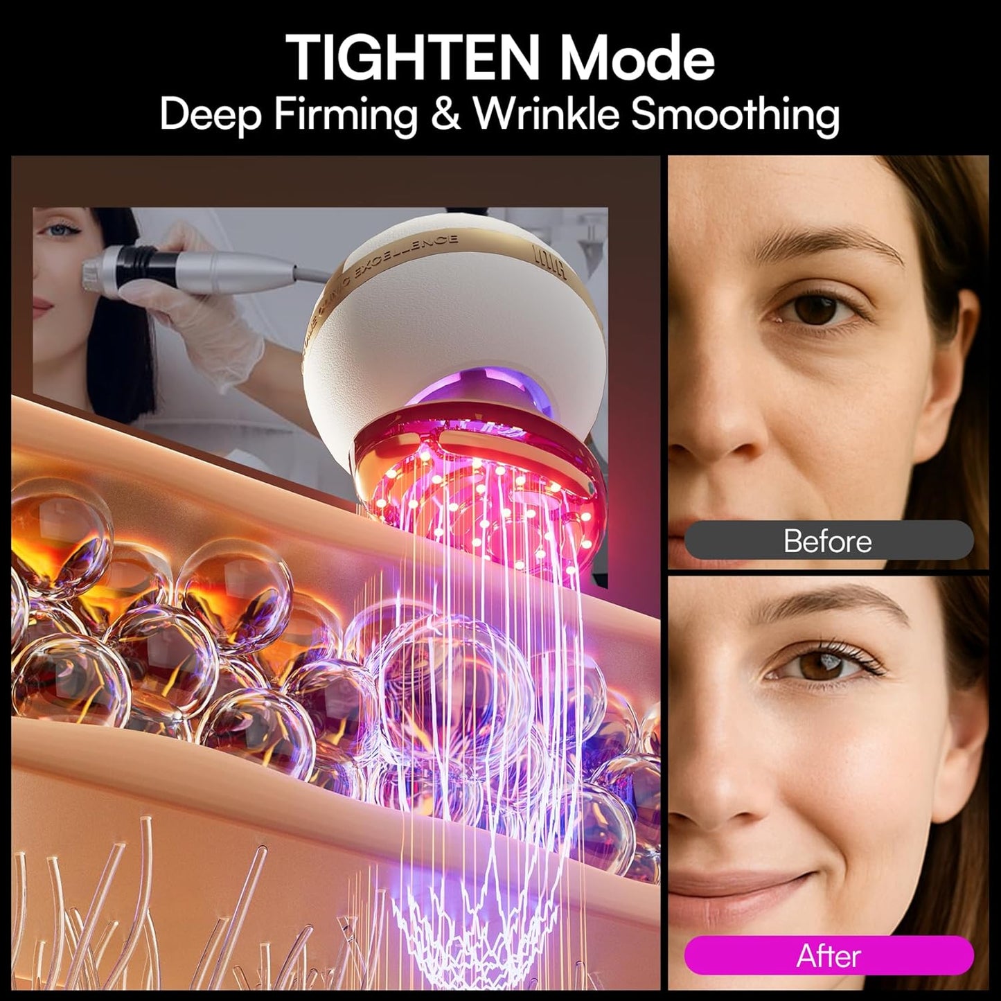 INIA SPHERA 8-in-1 Microcurrent Facial Device - Red Light & Cooling Tool for At-Home Skin Care | 5 Custom Modes
