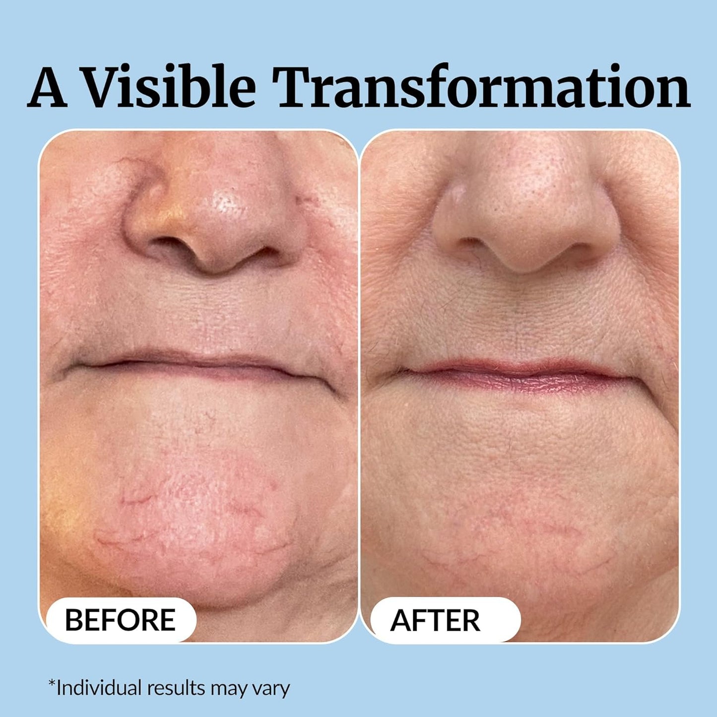 Vibriance Super C Serum for Mature Skin - All-in-One Vitamin Formula for Hydration, Firming & Wrinkle Reduction | 1 fl oz