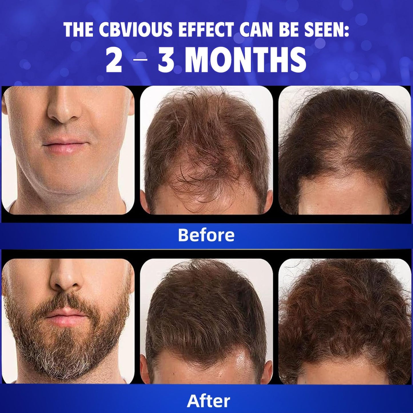 5% Minoxidil Hair Regrowth Serum for Women & Men, Rosemary Oil Biotin Batana Oil Topical Treatment Thinning Hair Loss Receding Hairline Non-Greasy Unscented 4-Pack 6 Month Supply