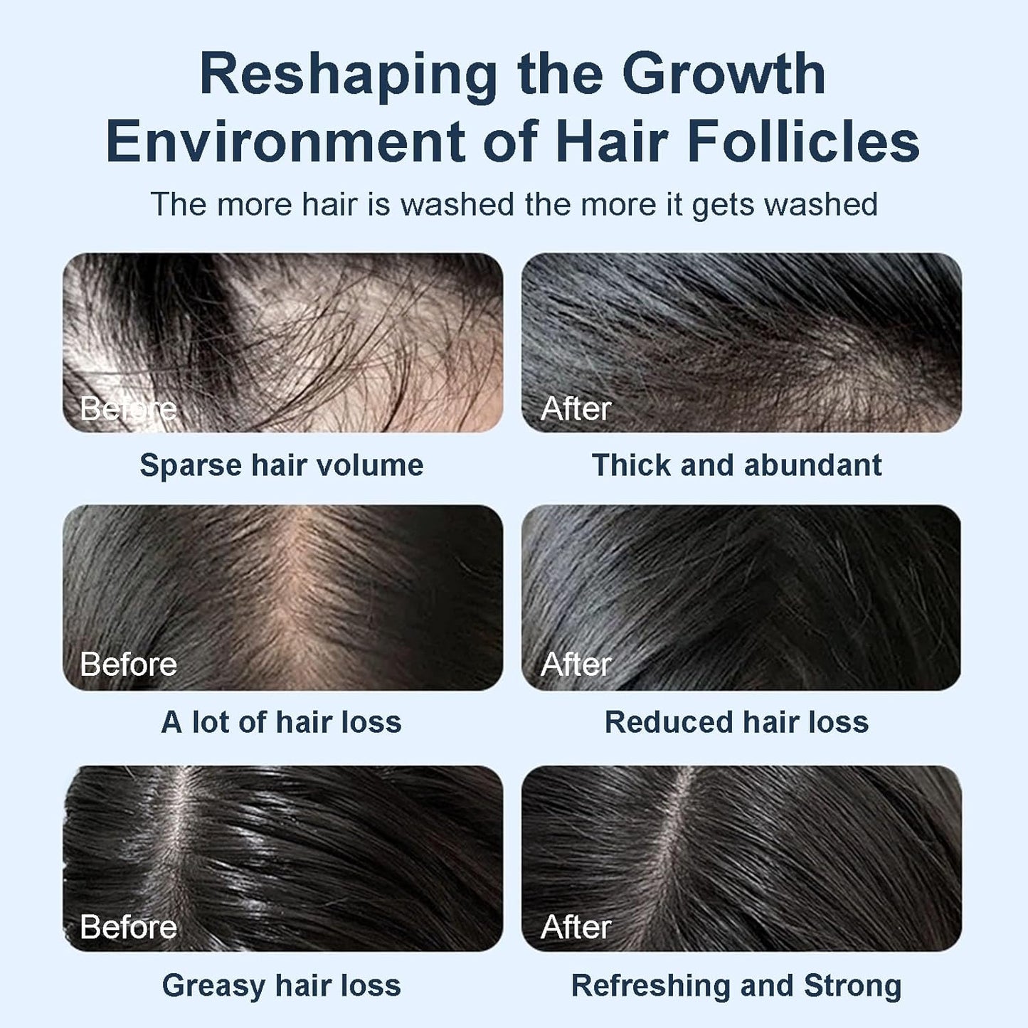 Hair Growth Shampoo for Thinning Hair - Biotin & Rosemary Volumizing Formula for Fuller, Thicker Hair | 15.2 fl. oz.