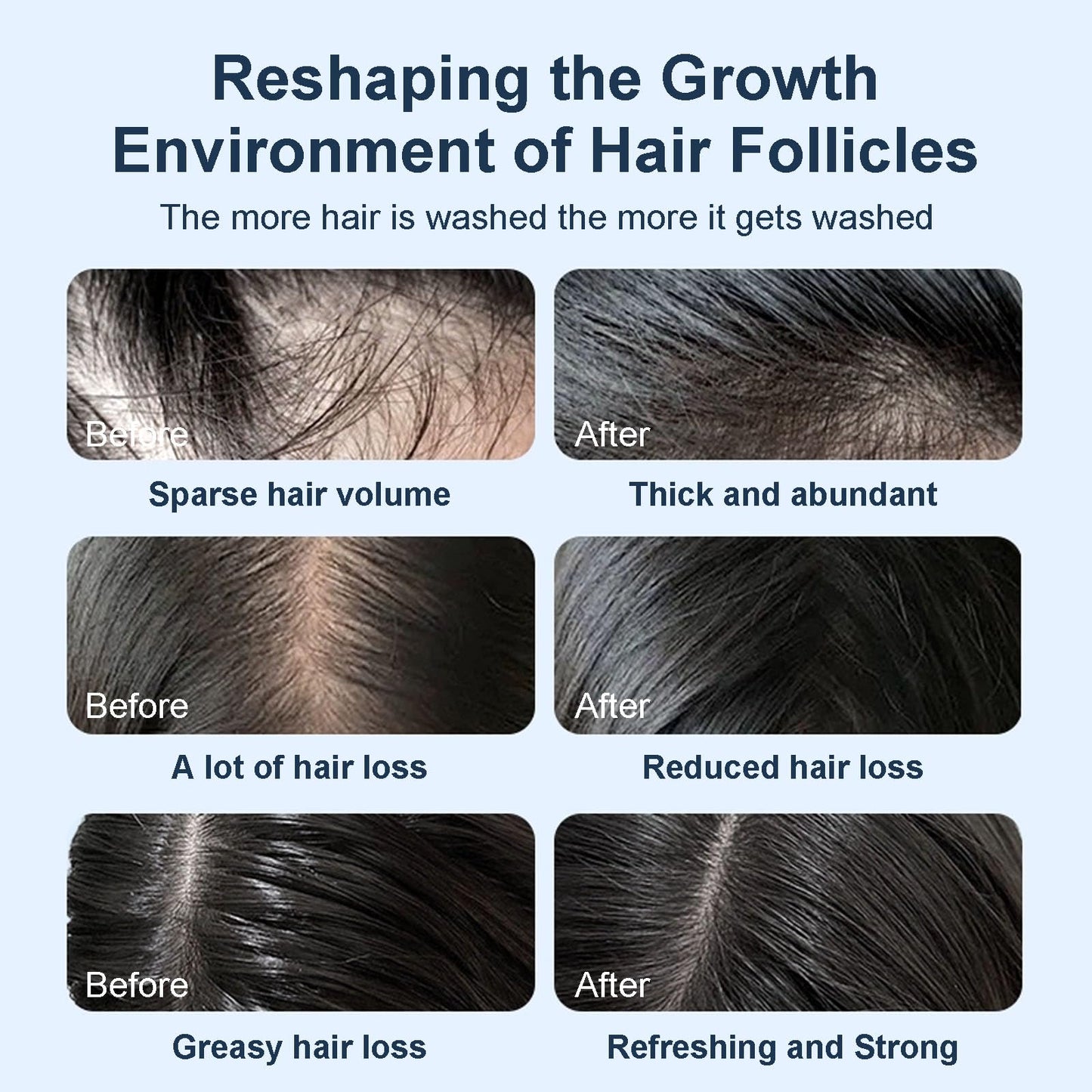 Tgideas Hair Growth Shampoo for Thinning Hair, Biotin & Rosemary Shampoo for Fuller, Thicker Hair, Volumizing & Strengthening Formula with Amino Acids, Dandruff Control for Women & Men - 15.2 fl.oz