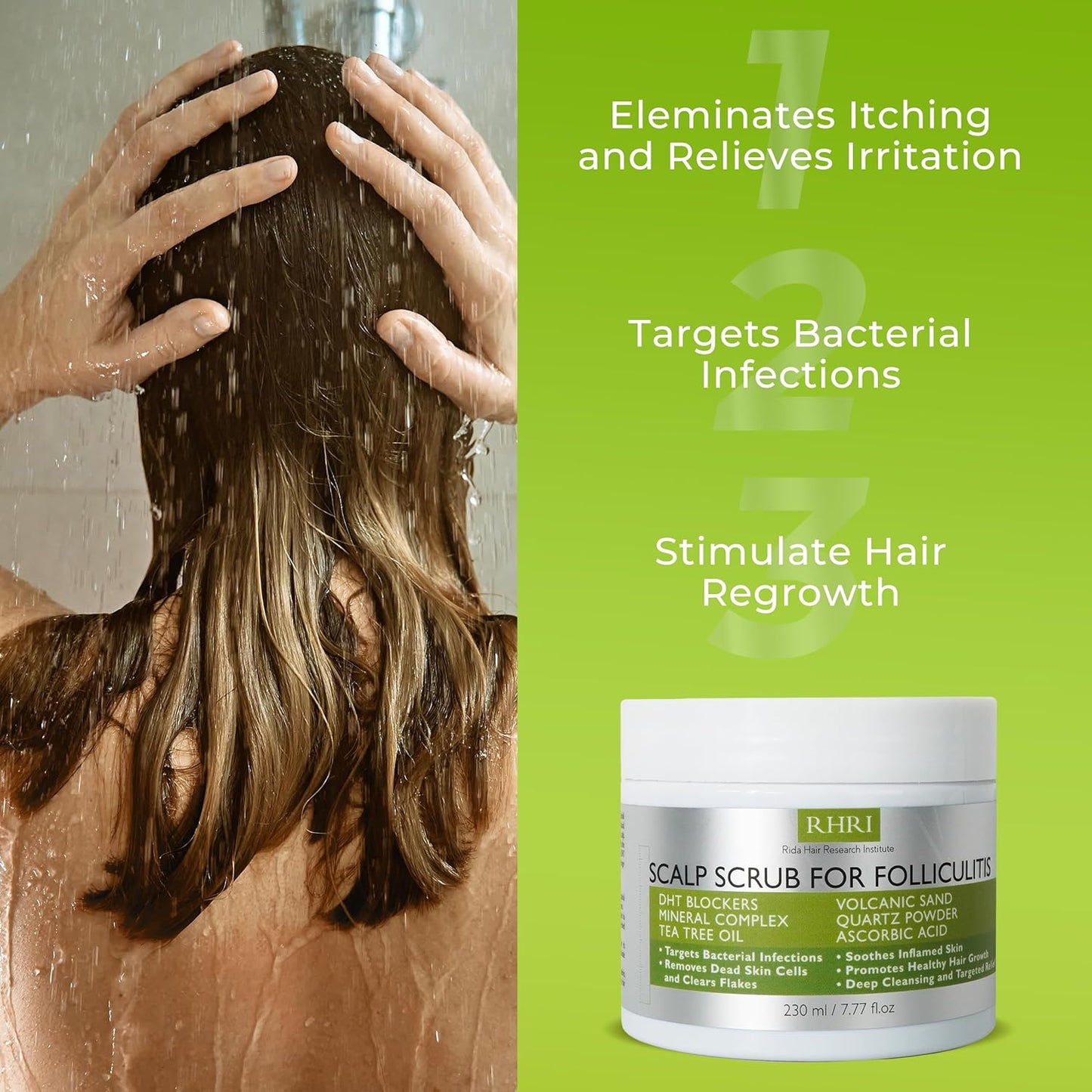Anti-Fungal Scalp Scrub for Folliculitis - Pre-Shampoo Treatment for Dandruff, Psoriasis & Seborrheic Dermatitis