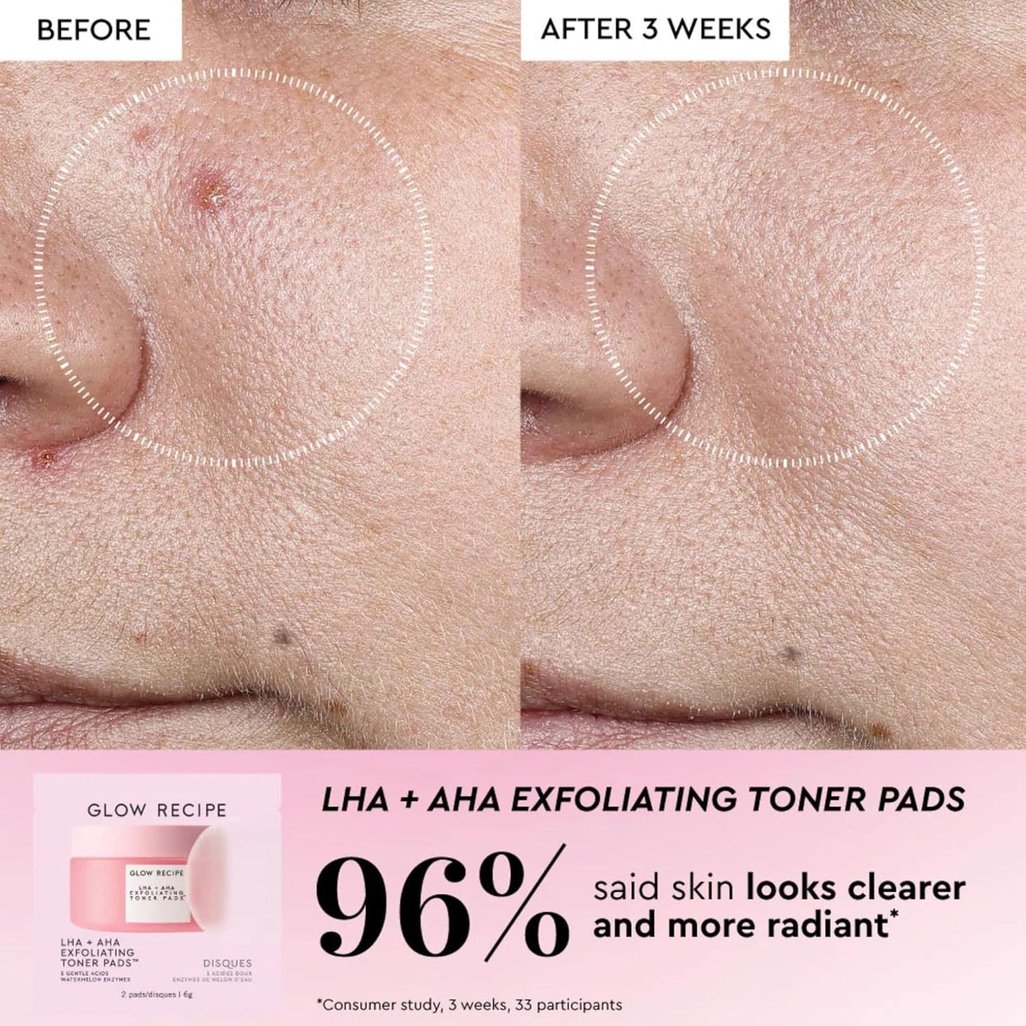 Glow Recipe Toner Pads Kit - 12-Piece Korean Exfoliating & Soothing Facial Treatment | Fragrance-Free for Sensitive Skin