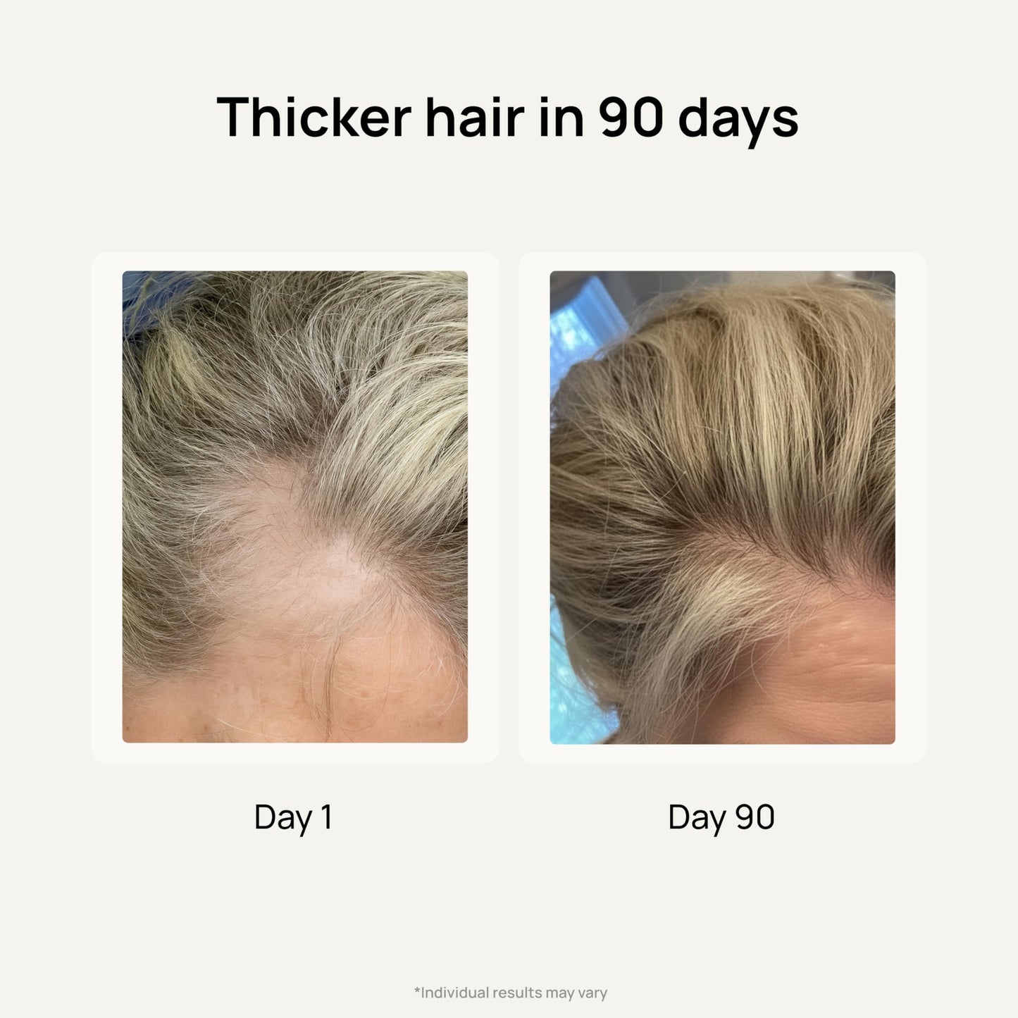 Lunos Grow Hair Growth Supplements - 17 Ingredient Hair Vitamins for Women & Men with Biotin, Saw Palmetto, & Marine Collagen - 1 Month Supply