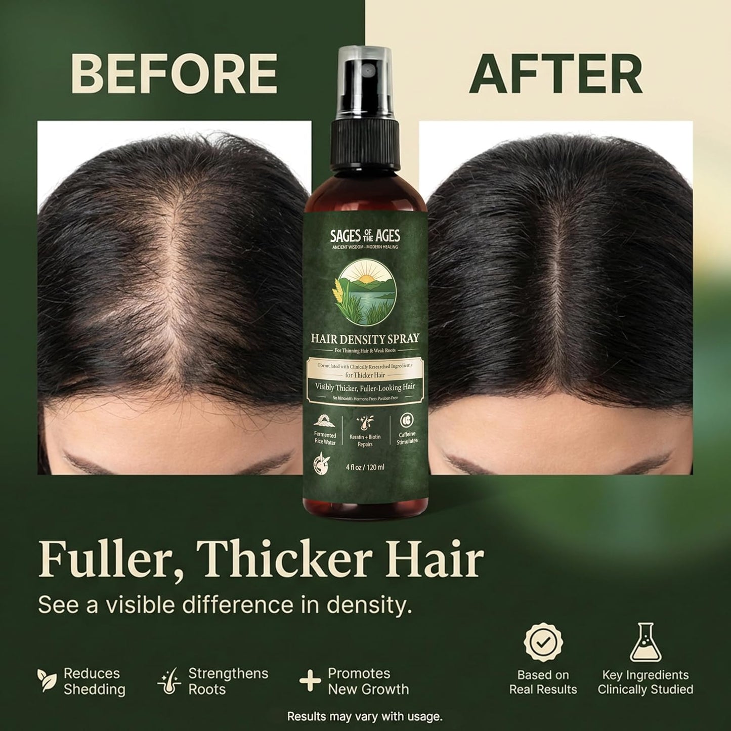 Fermented Rice Water Hair Growth Spray - Strengthening Leave-In Mist with Rosemary & Biotin | 4oz Hydrating Formula for Thinning Hair