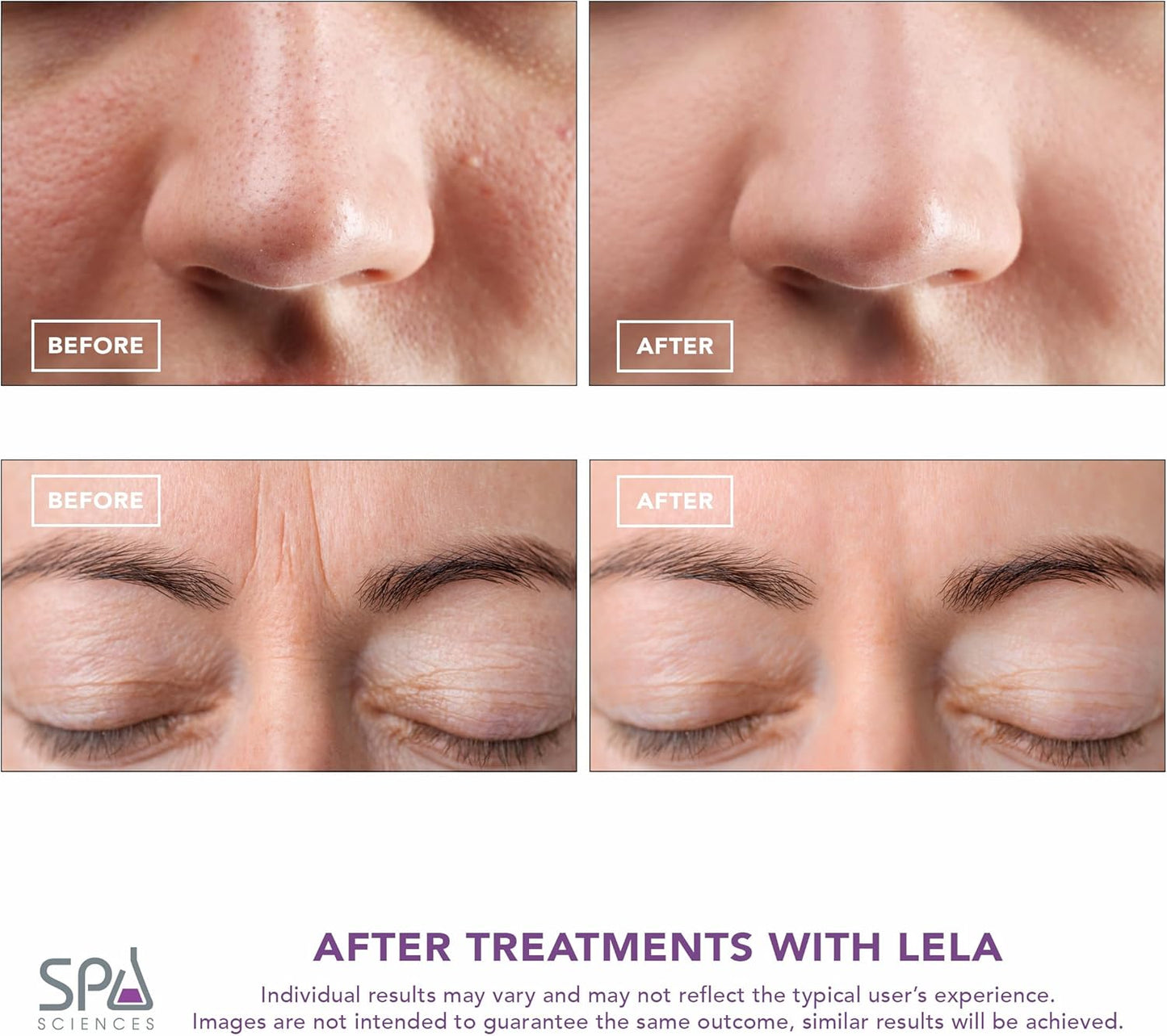 Spa Sciences LELA 4-in-1 Facial Spatula | Deep Cleansing, Pore Extraction & Anti-Aging Benefits