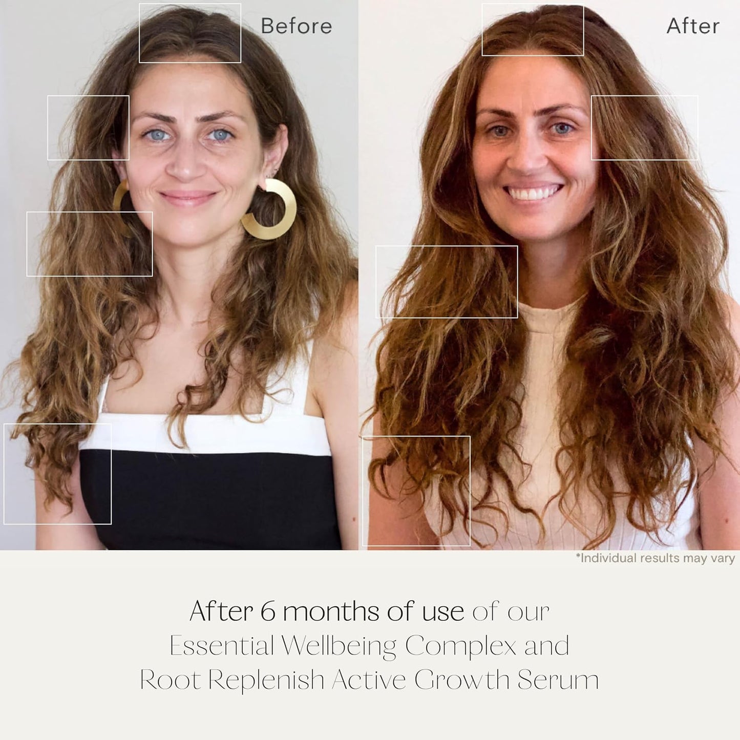 Active Growth Hair Serum - Redensyl DHT Blockers & Scalp Support | 40mL Lightweight Formula for Thicker, Fuller Hair