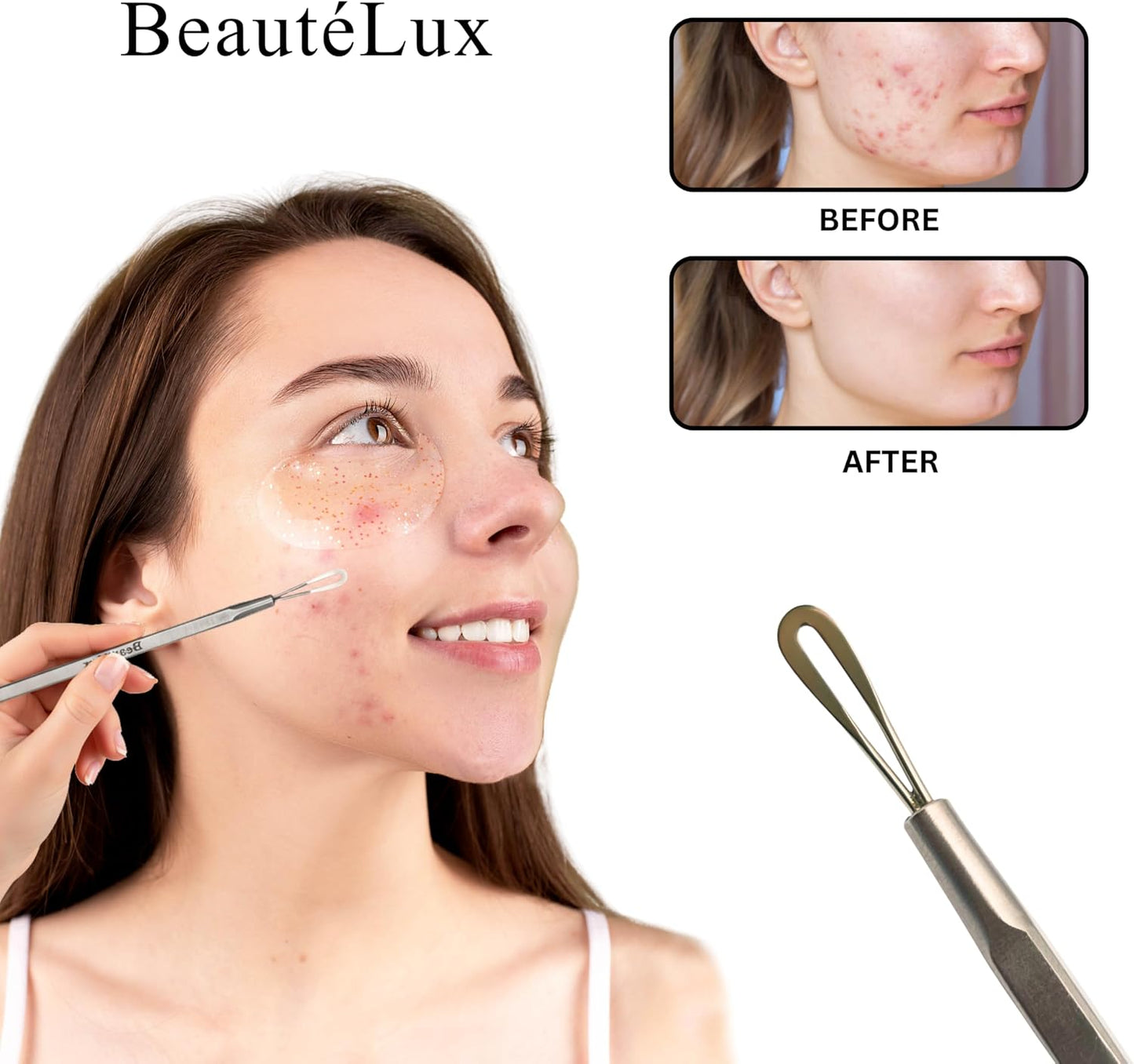 Blackhead Removal Tool - 2-in-1 Stainless Steel Acne Extractor | Dual-Loop Pimple Remover with Grey Leather Pouch