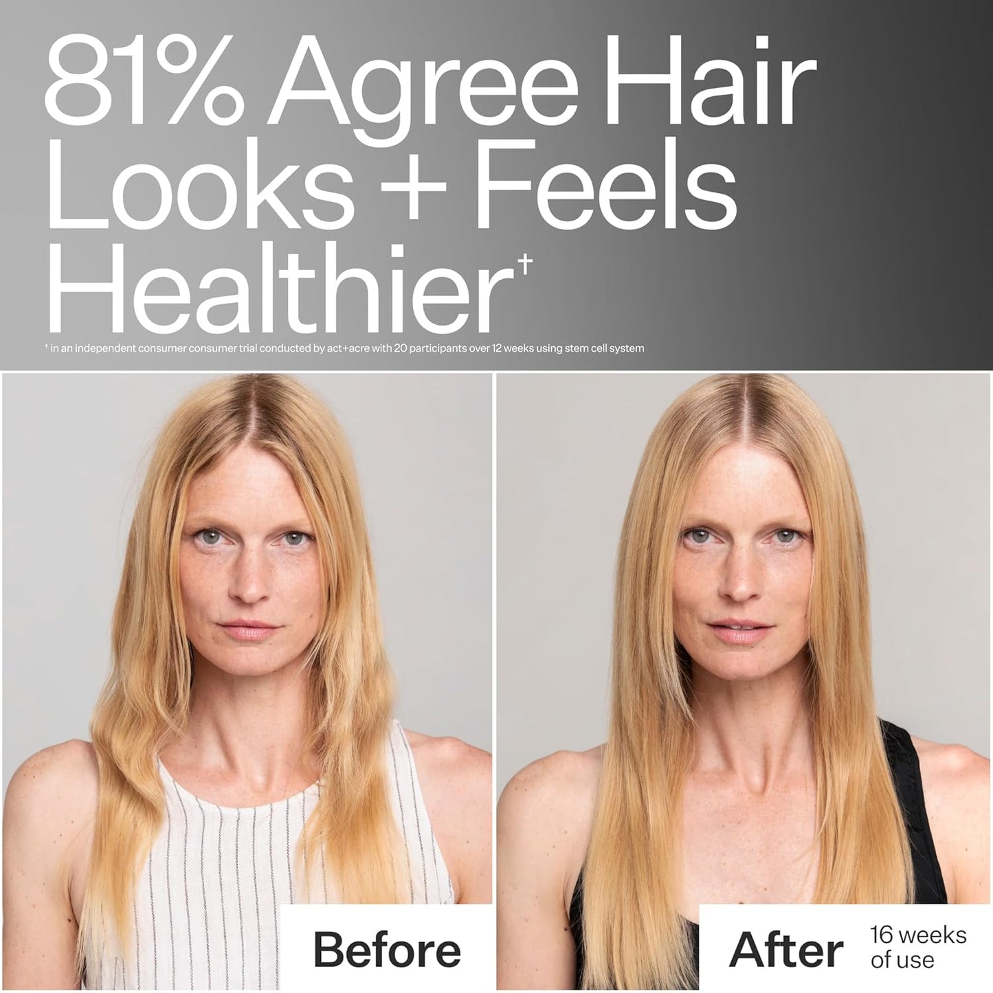 Act+Acre Stem Cell Conditioner - Strengthens & Hydrates Fine Hair | Lightweight, Vegan, Color Safe | 10 Fl Oz