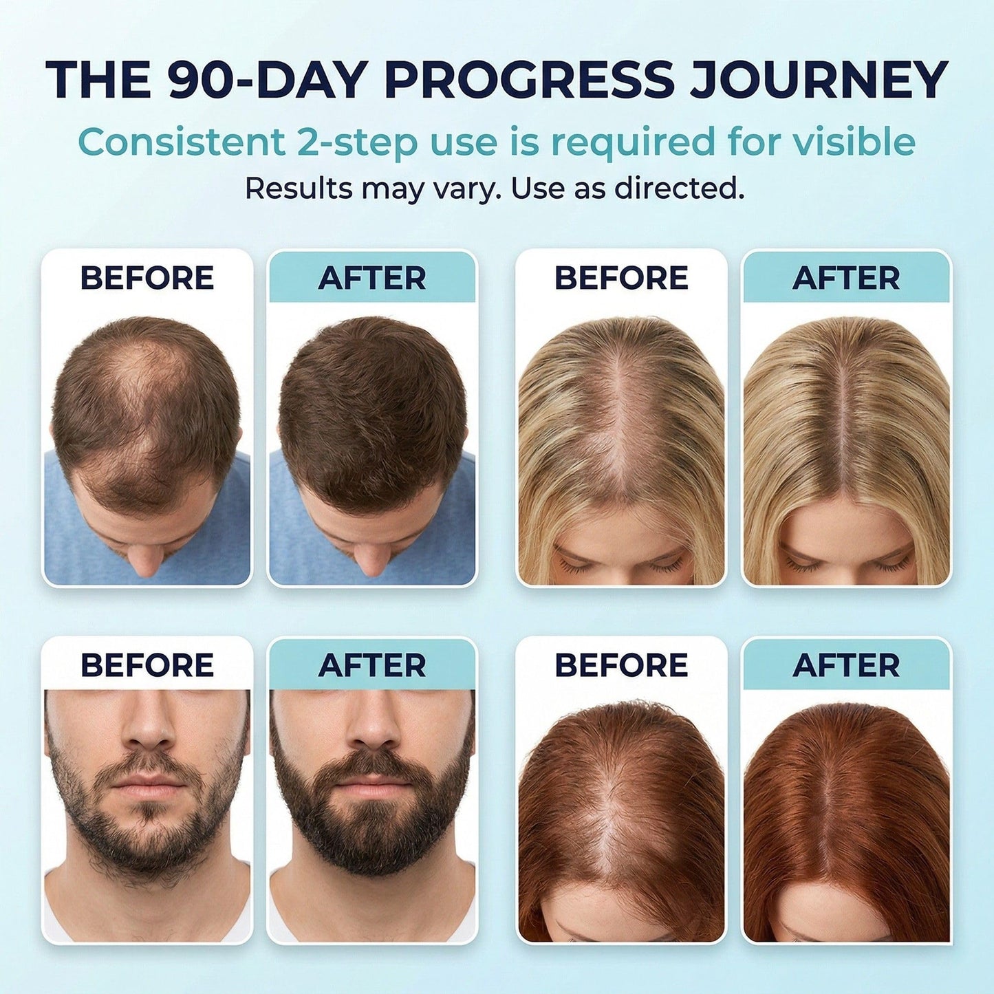 5% Minoxidil Foam for Men and Women: 2-Pack Travel Size 1oz Cans - Topical Hair Regrowth Treatment & Follicle Reactivator for Thinning Hair - Fast-Absorbing Recovery Kit - 1 Month Supply