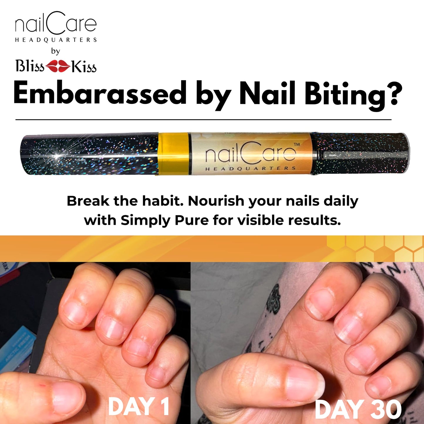 Nail Care Headquarters Simply Pure Cuticle Oil Pen for Nails - Nail Strengthener & Growth Serum for Damaged Nails, Hangnails w/Jojoba cuticle oil—Milk & Honey Fragrance