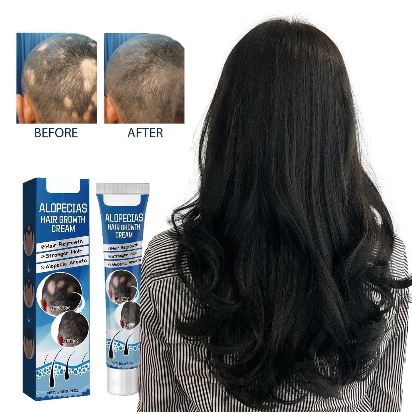 Alopecia Hair Products Suitable for Men & Women