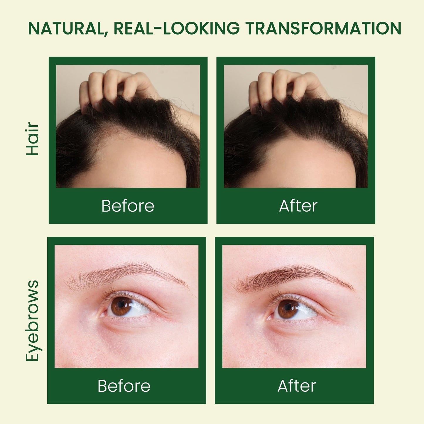 Pure Castor Oil (10oz) - Cold Pressed 100% Castor Oil for Hair Growth, Skin, Eyebrows, Eye Lashes, Nails & Cuticles - Hexane Free, Natural & Unrefined - Includes Dual Mascara, Dropper & LuxoLook