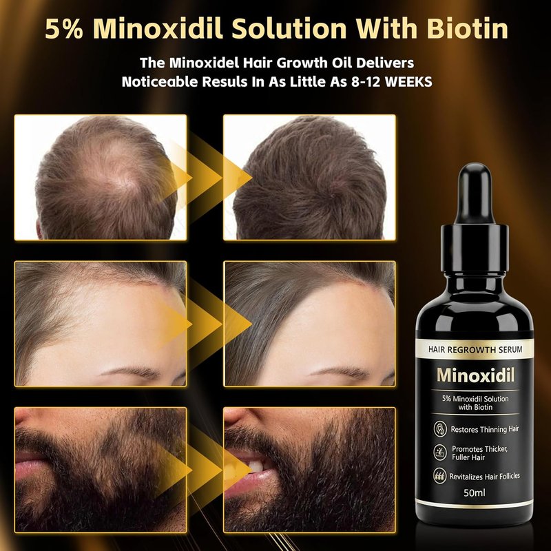 Minoxidil Essence 5% - Hair & Beard Growth Serum for Men & Women | Strengthens Roots & Activates Follicles, 1.76 fl oz - Black