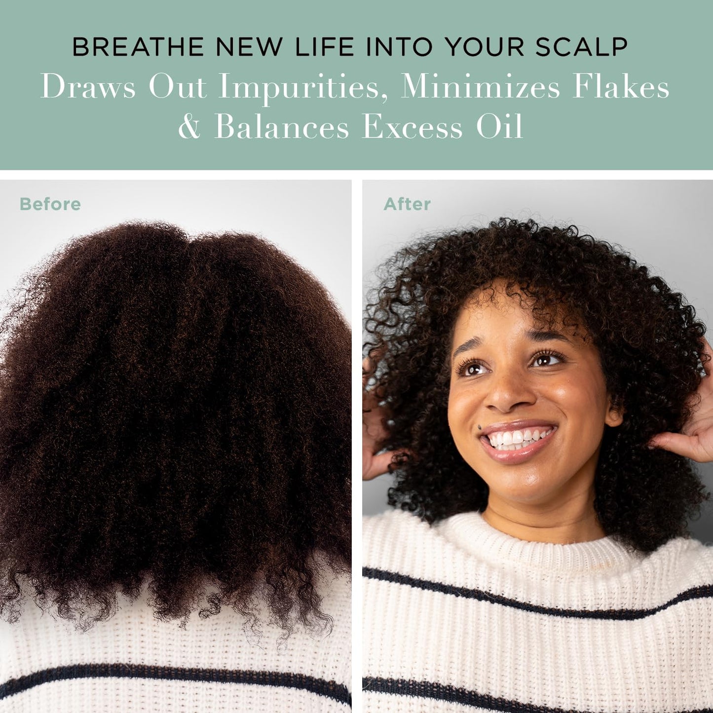 Charcoal Detox Scalp Scrub - Exfoliate & Rebalance Dry, Itchy Scalps | Paraben-Free, 8.82 oz