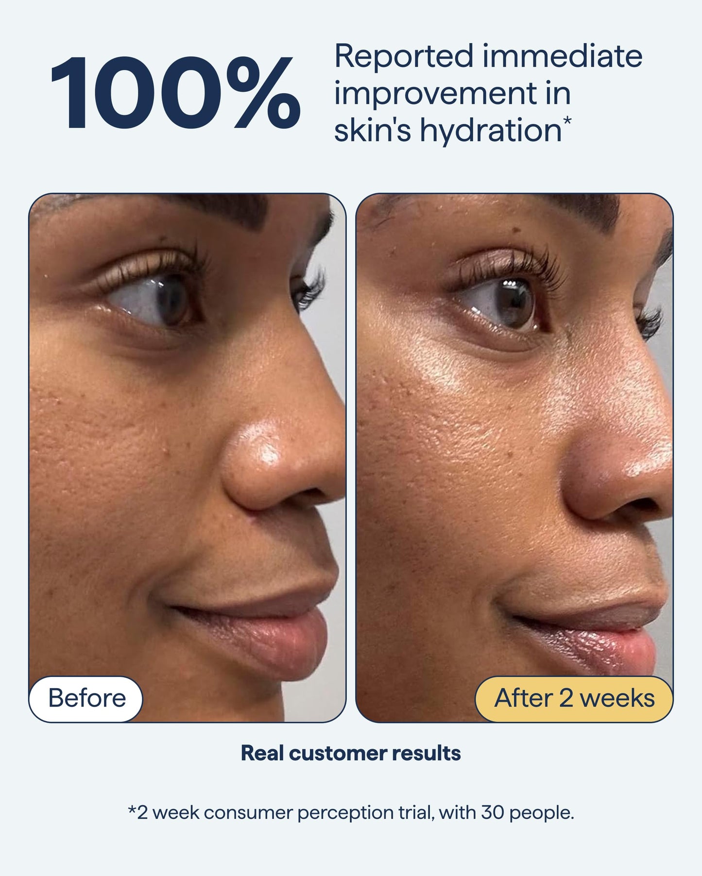 Remedy Rich Barrier Repairing Cream Face Moisturizer | Quadruple Ceramide Complex, Peptides and Squalane | Fragrance Free | Eczema Certified | Dry Sensitive Skin | By Dermatologist Dr Shah | 1.7 fl oz