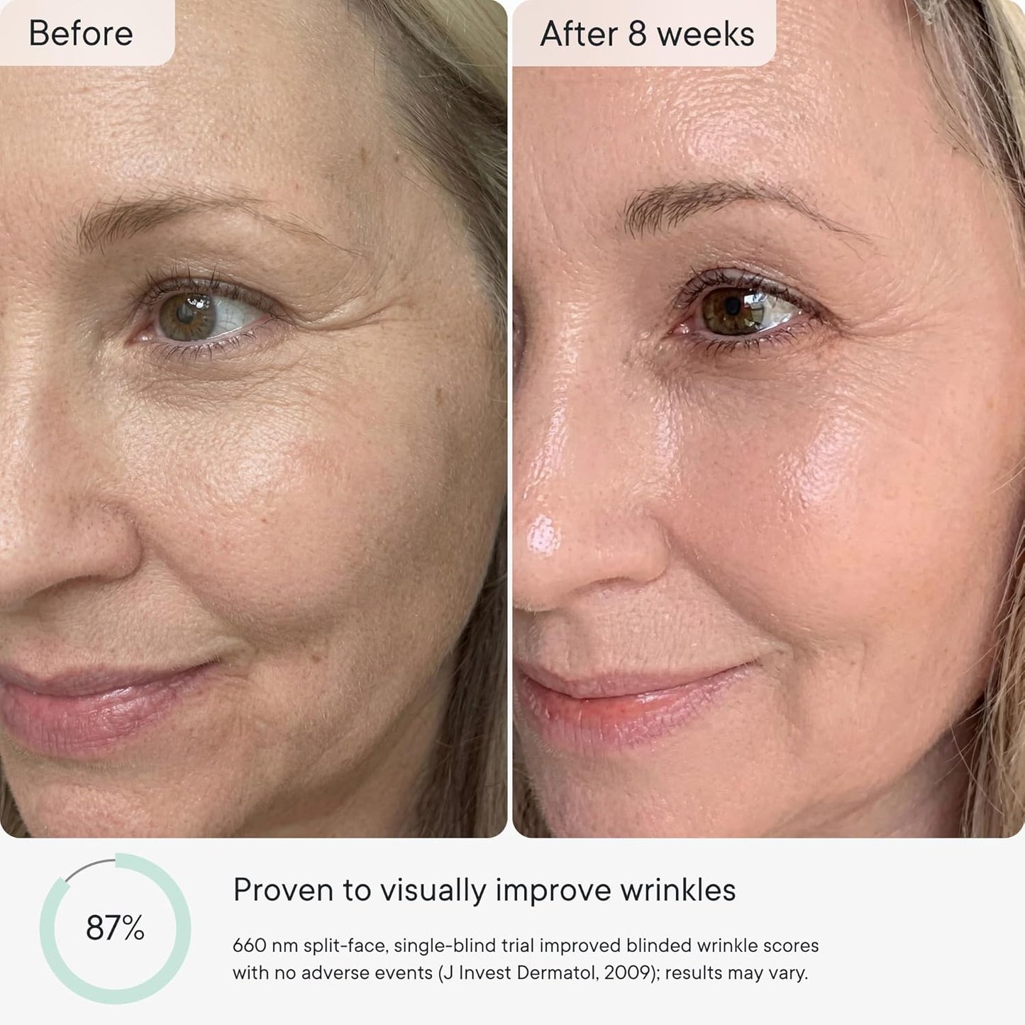 LED Light Therapy Mask for Face - FDA Cleared Wrinkle & Acne Treatment | 3 Modes, 5 Areas, 5 Lights