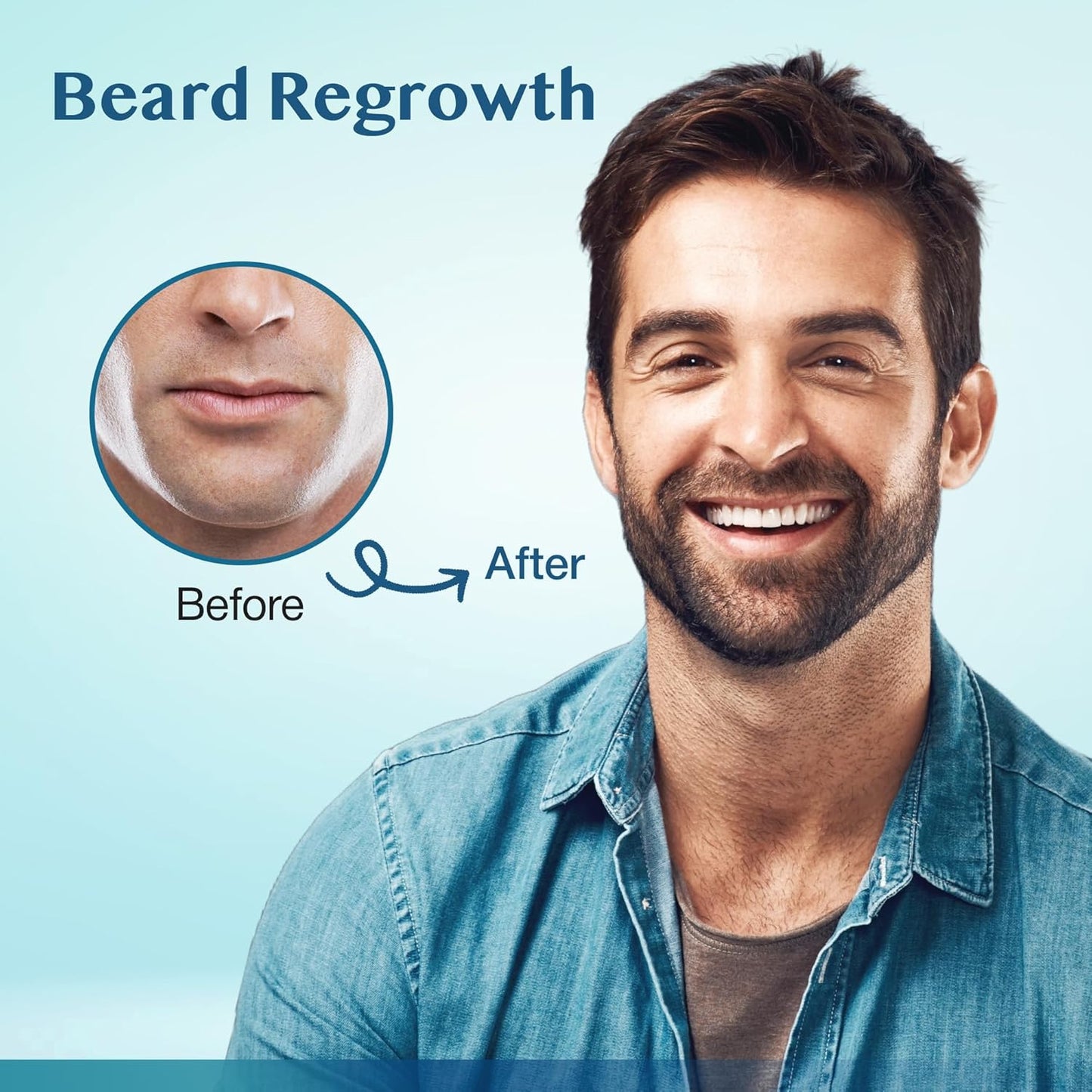 Minoxidil Hair Growth Serum - Extra Strength Beard Regrowth Treatment with Biotin | 60ml, 3 Bottles