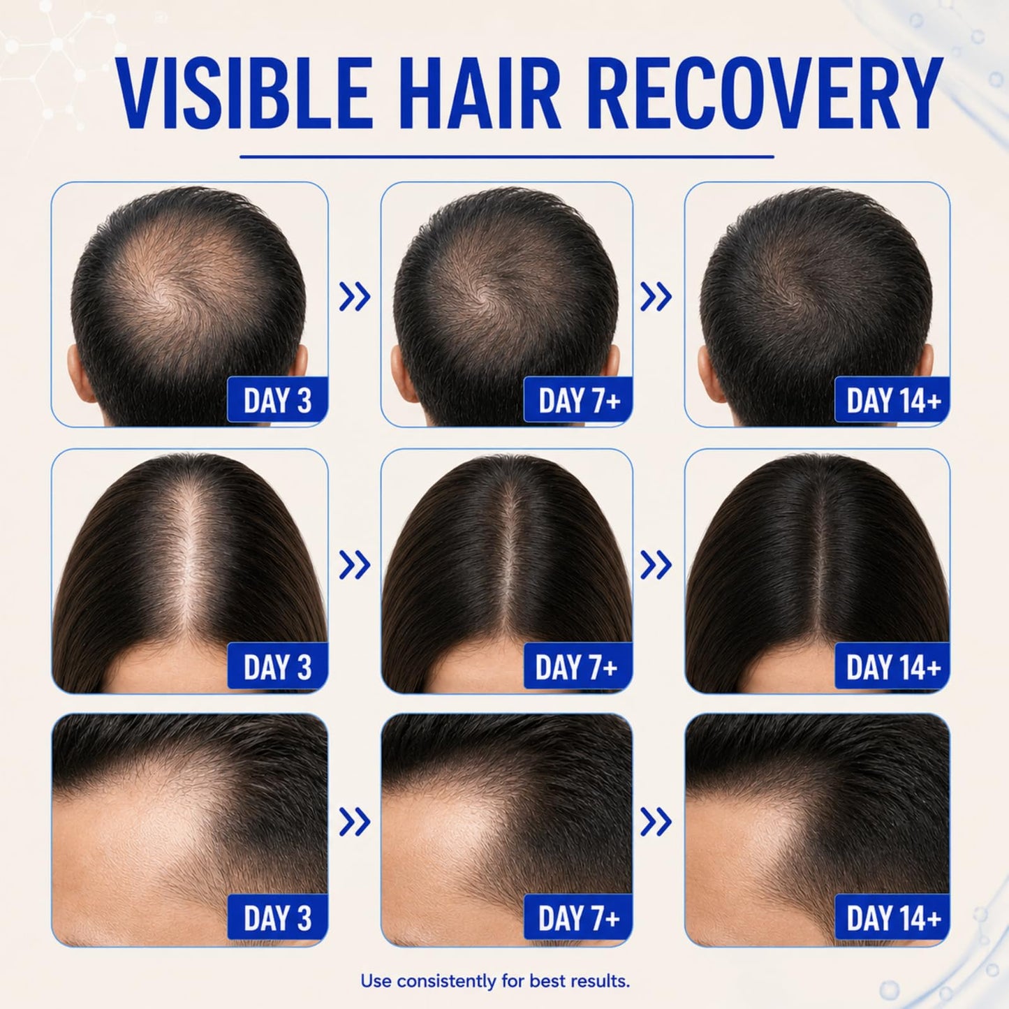 Ultrastrong 10% Copper Peptides for Hair Growth, GHK-Cu Scalp Serum, Water-Based Scalp Treatment for Thinning Hair, Non-Greasy Leave-In Formula with Biotin & Rosemary, For Women & Men, 1 Fl Oz