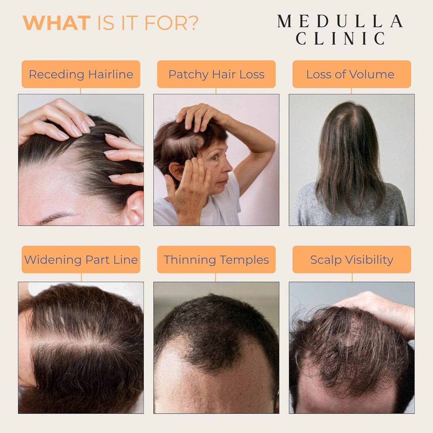 Hair Growth Serum Roll-On | 5% Rosemary & 3% Protein for Scalp Thickening - Non-Greasy Treatment, 1 fl oz (30 ml)