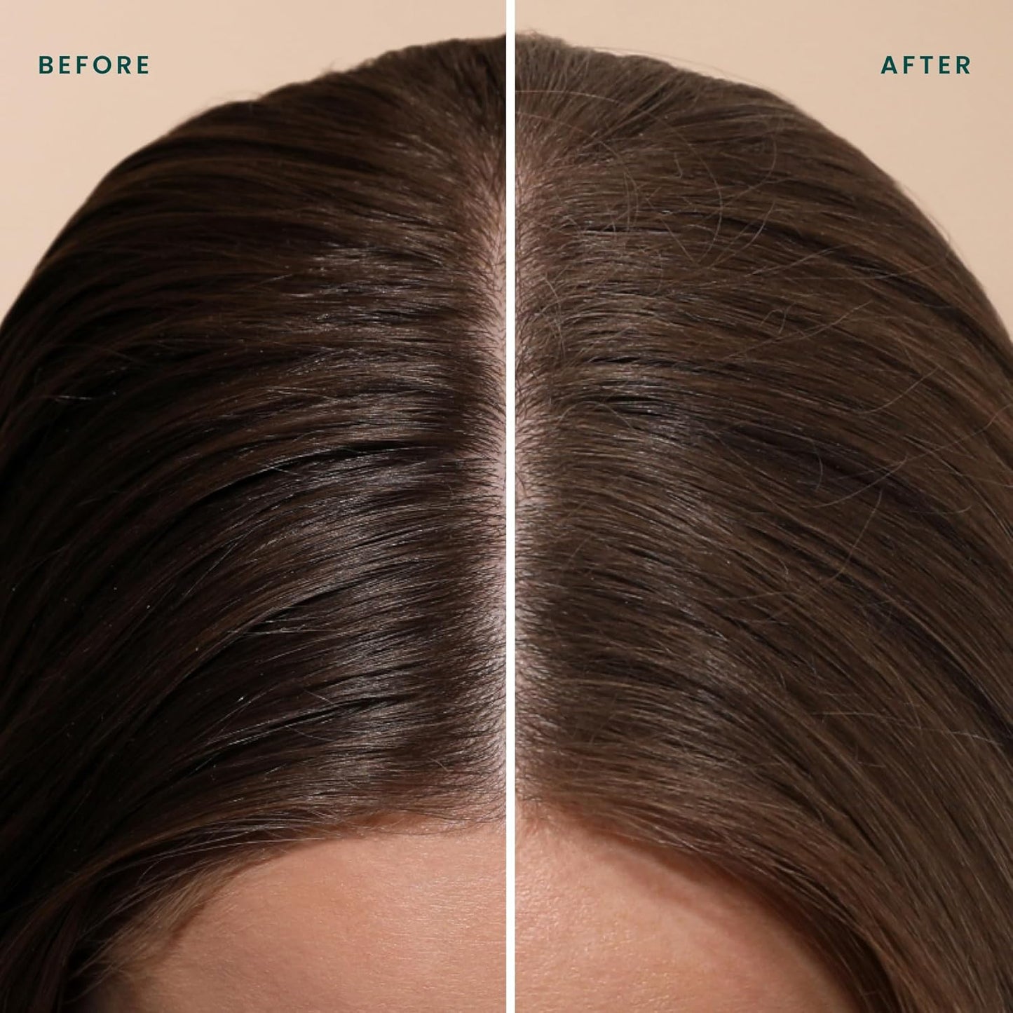 Detox Dry Shampoo Spray - Absorbs Oil & Adds Volume | For All Hair Types