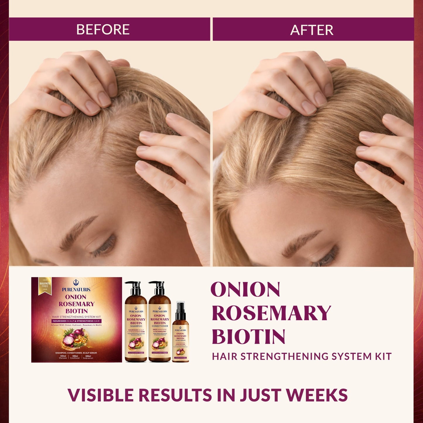 Onion Rosemary Biotin Hair Care Set – Sulfate Free Shampoo, Conditioner & Scalp Serum – Helps Strengthen Hair, Reduce Breakage & Support Fuller, Thicker-Looking Hair – 3 Piece Set