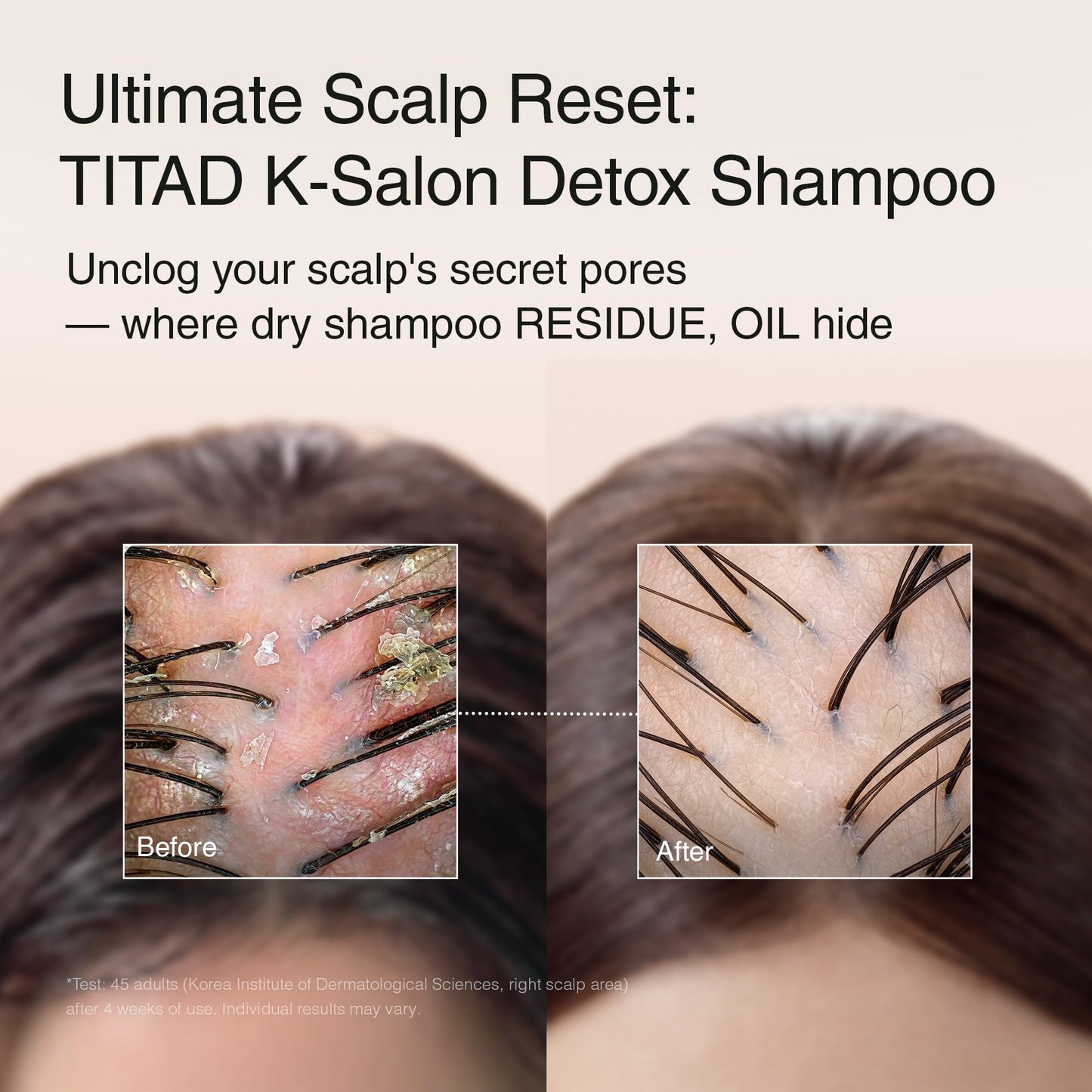 TITAD Scalp Detox Clarifying Shampoo for Buildup & Oily Scalp – Sulfate-Free Rice Water & AHA | Deep Cleansing for Dry Shampoo Residue | Korean Hair Care, Vegan
