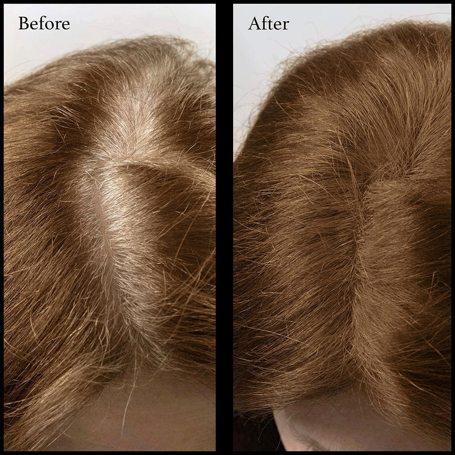 Root Touch Up Powder - 11 True-to-Nature Shades | Fragrance-Free Hairline Concealer, Warm Brown