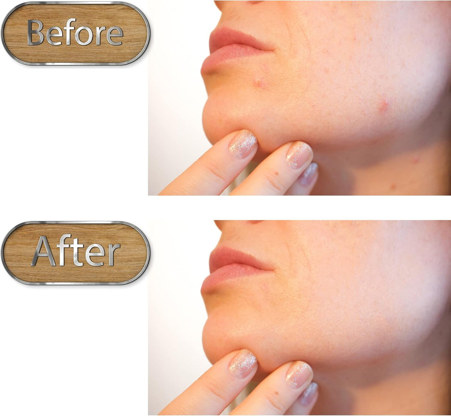 Pore Scraper Tool - Stainless Steel Double-Ended Facial Cleaner | Portable Skincare Tool for Nose & Face